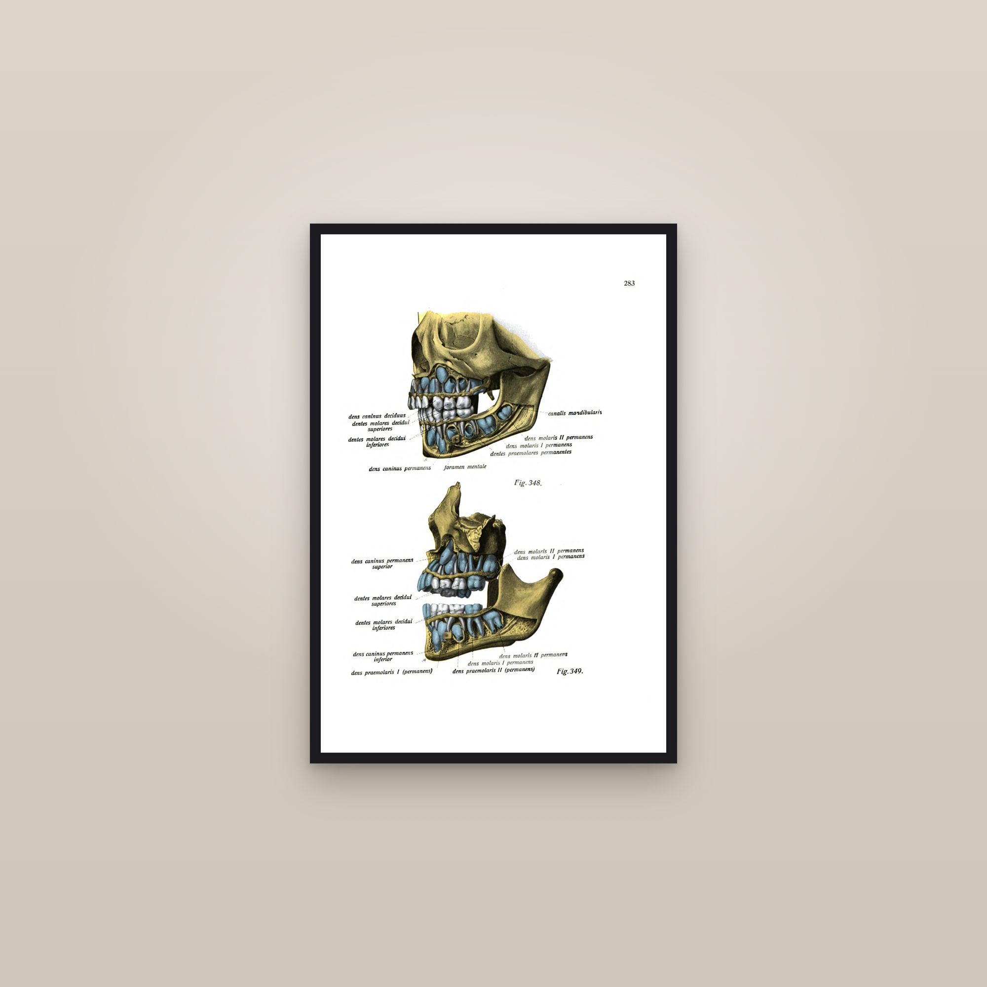 A Child's Skull with the Developing Teeth — framed in a gallery setting