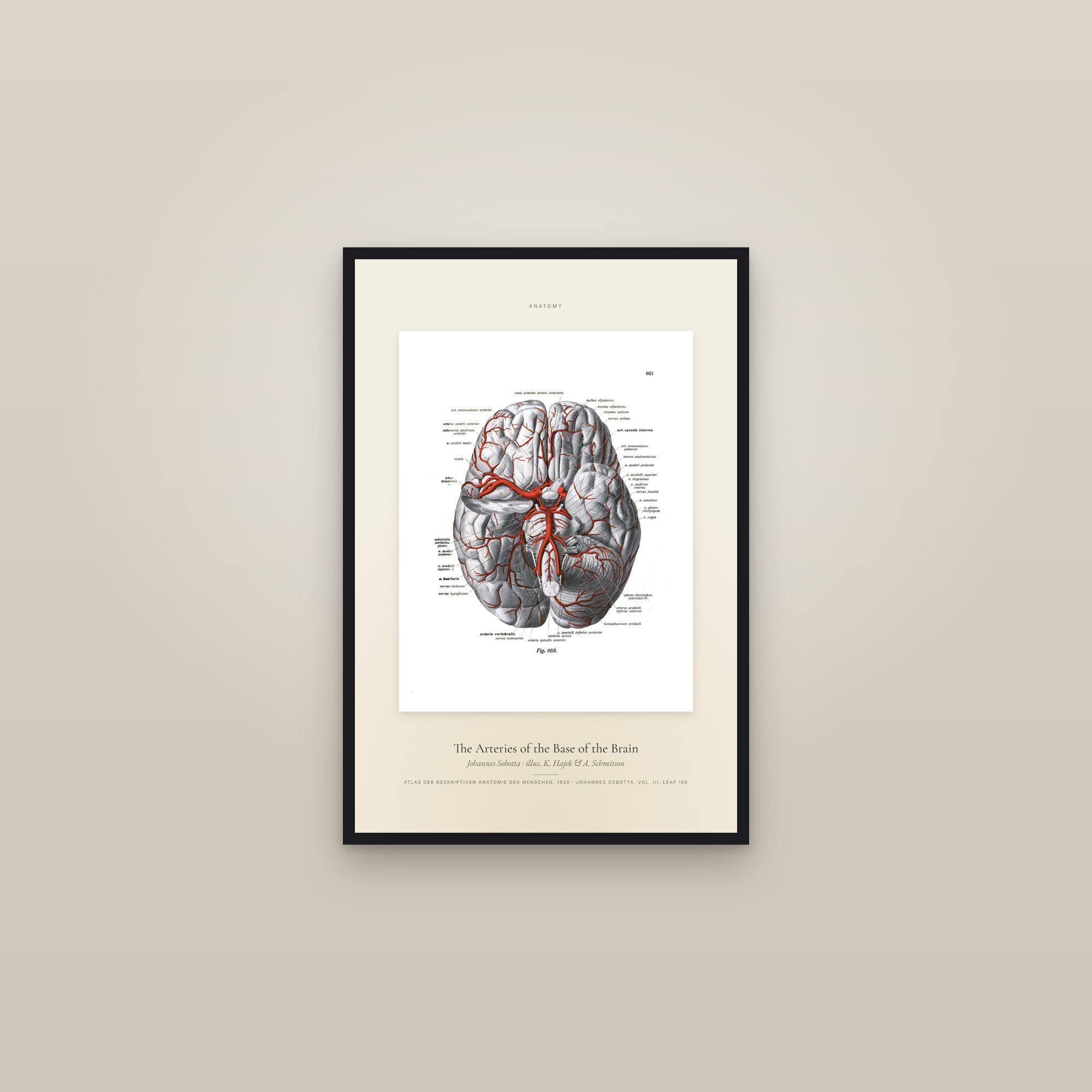 The Arteries of the Base of the Brain — Specimen