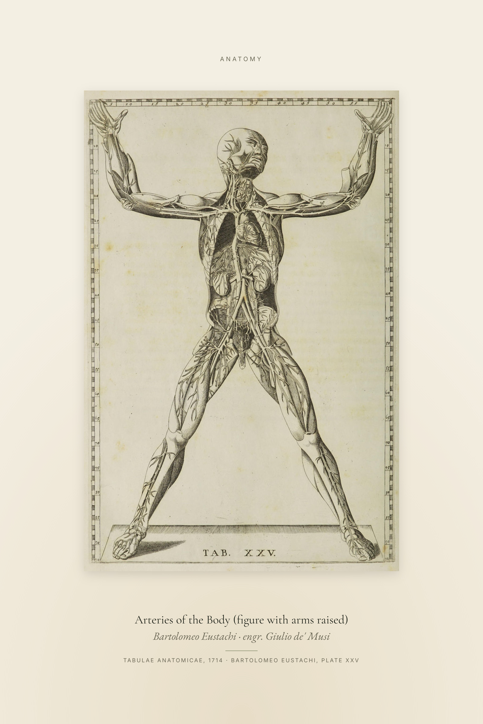 Arteries of the Body (figure with arms raised) — Specimen