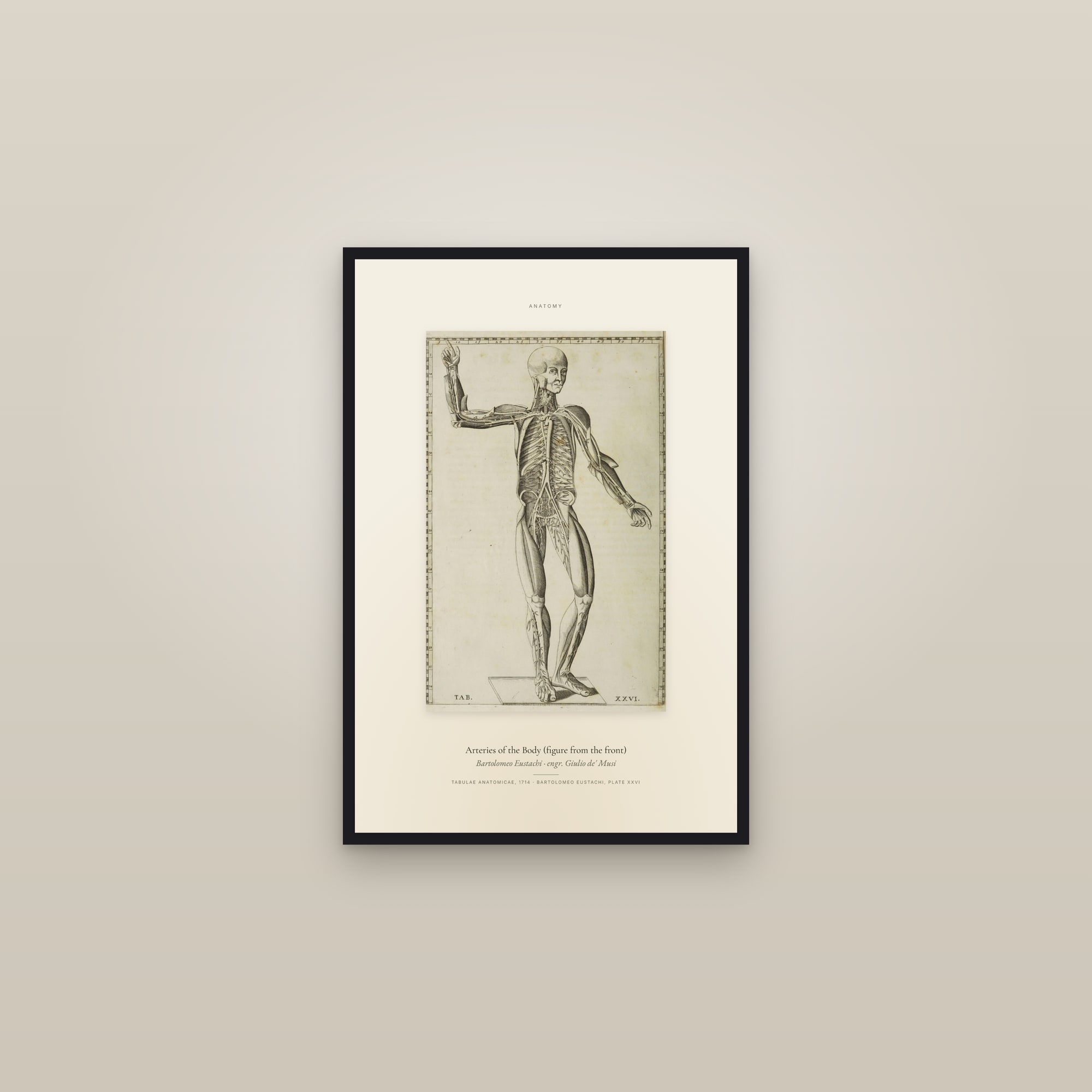 Arteries of the Body (figure from the front) — Specimen — framed in a gallery setting