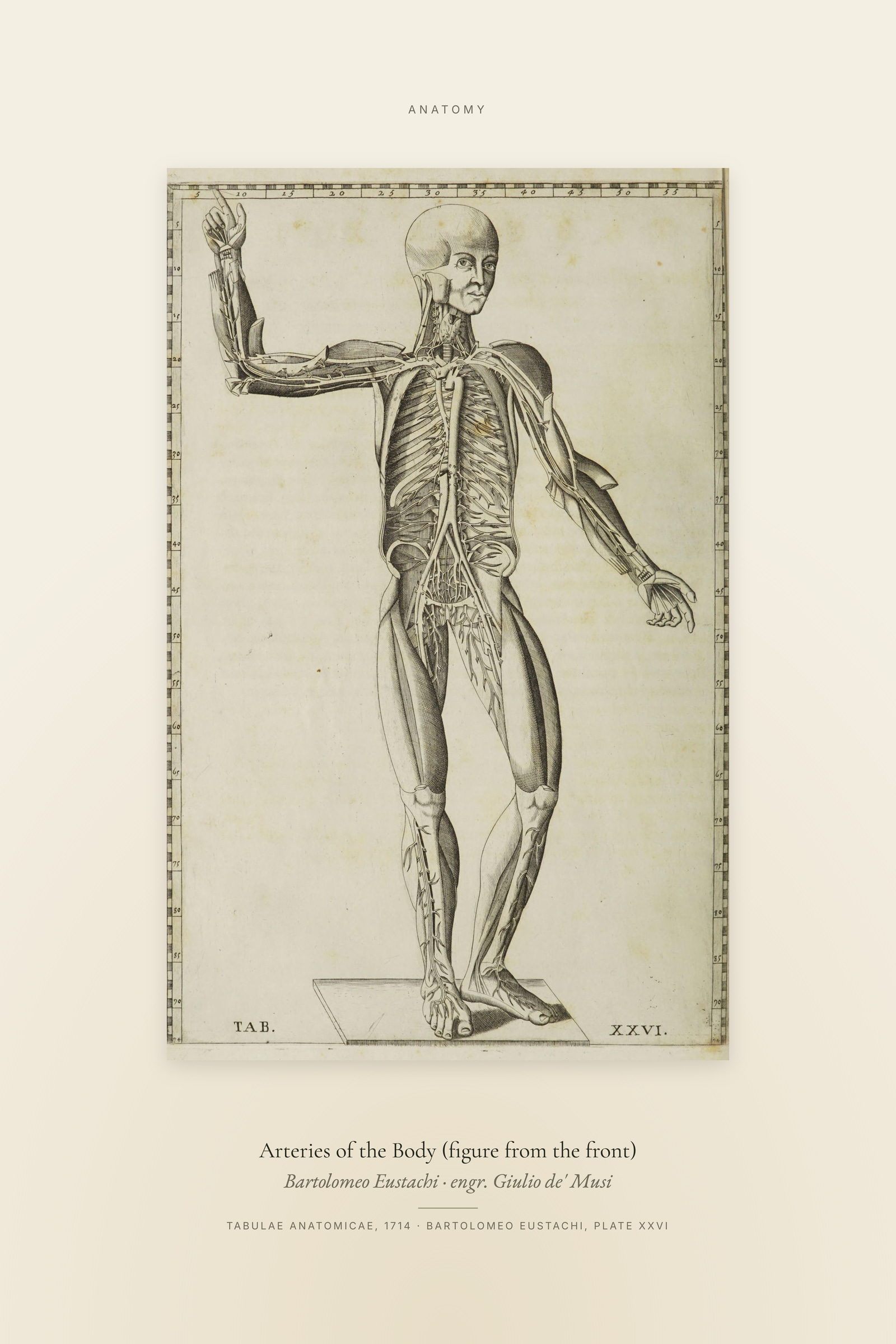 Arteries of the Body (figure from the front) — Specimen