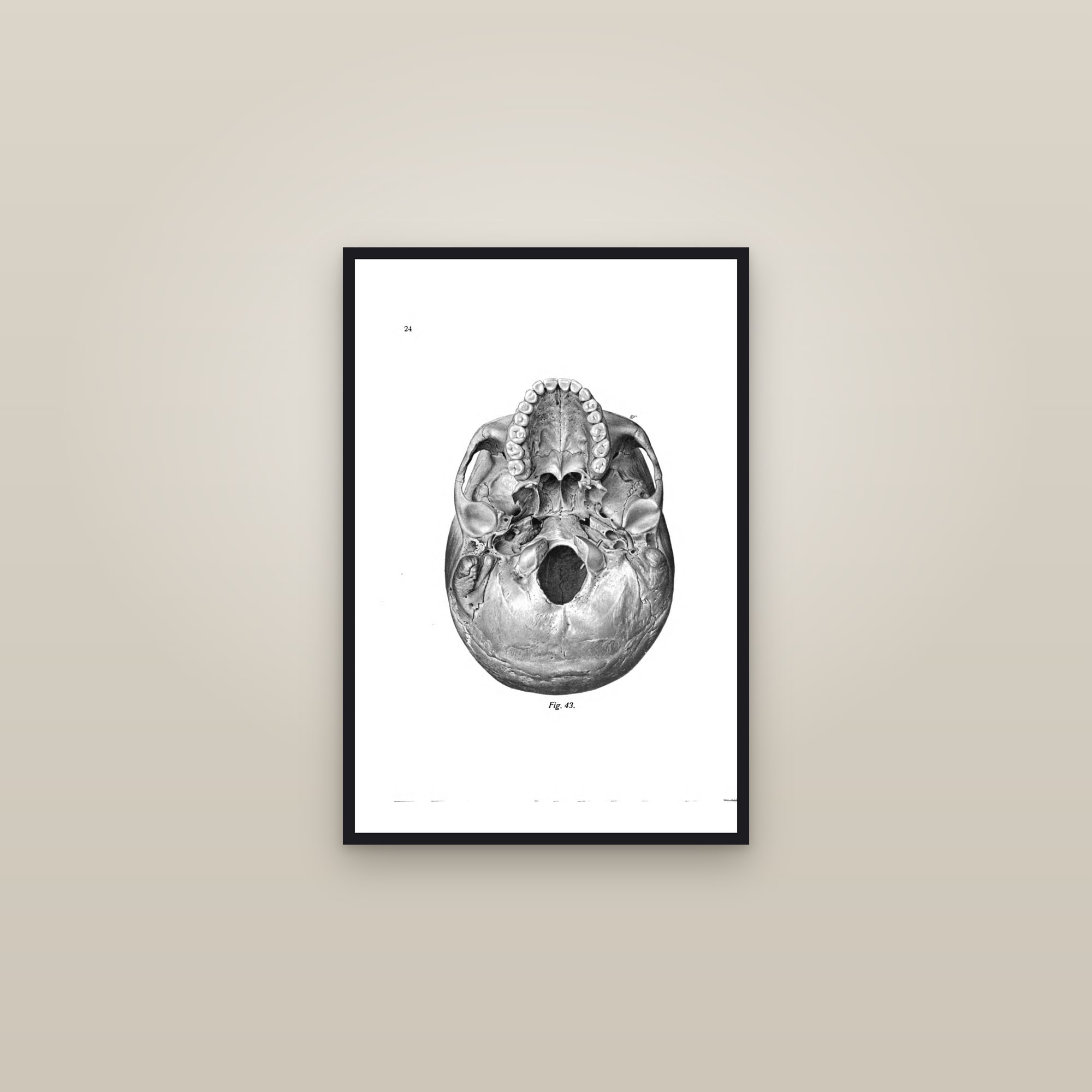 The Base of the Skull (from below) — framed in a gallery setting