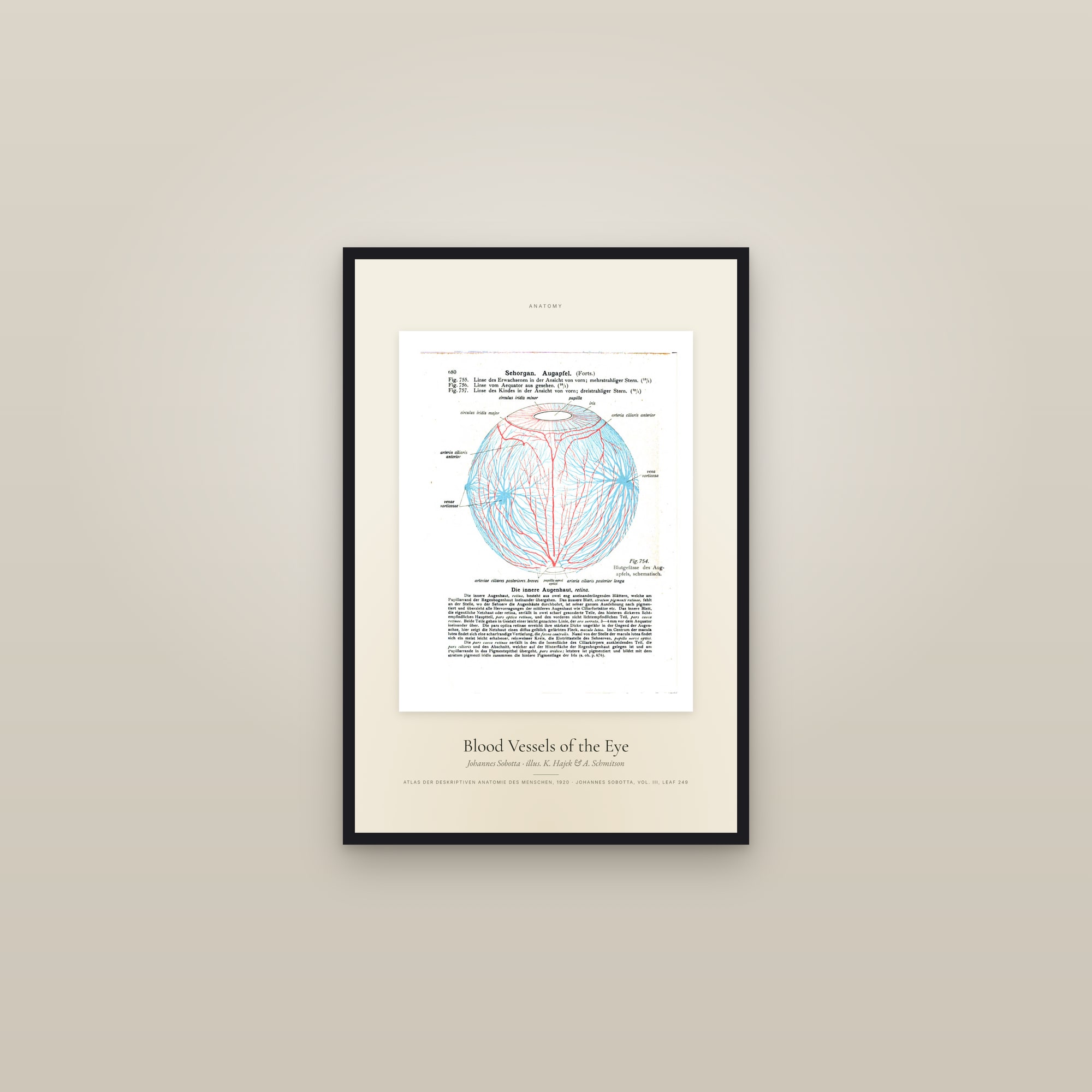 Blood Vessels of the Eye — Specimen — framed in a gallery setting