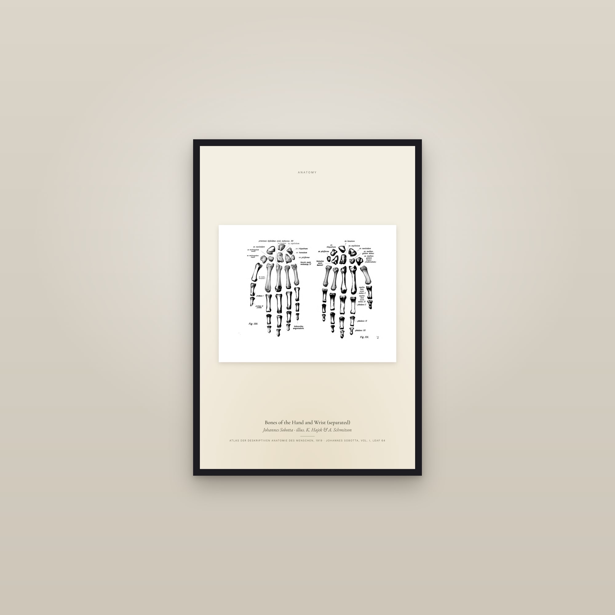 Bones of the Hand and Wrist (separated) — framed in a gallery setting