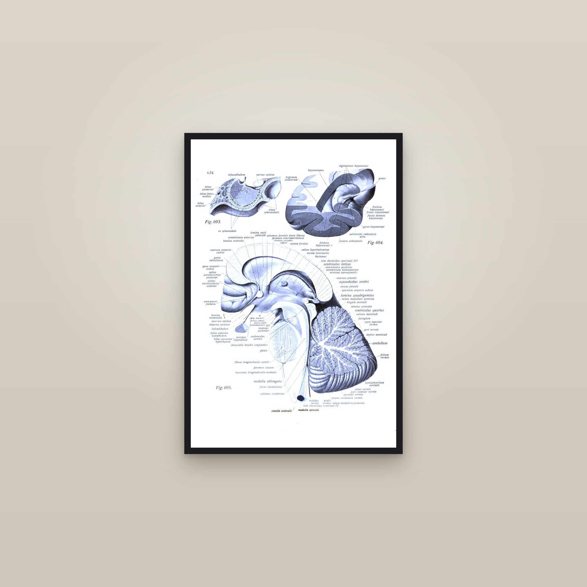 The Brain in Sagittal Section (in colour) — framed in a gallery setting