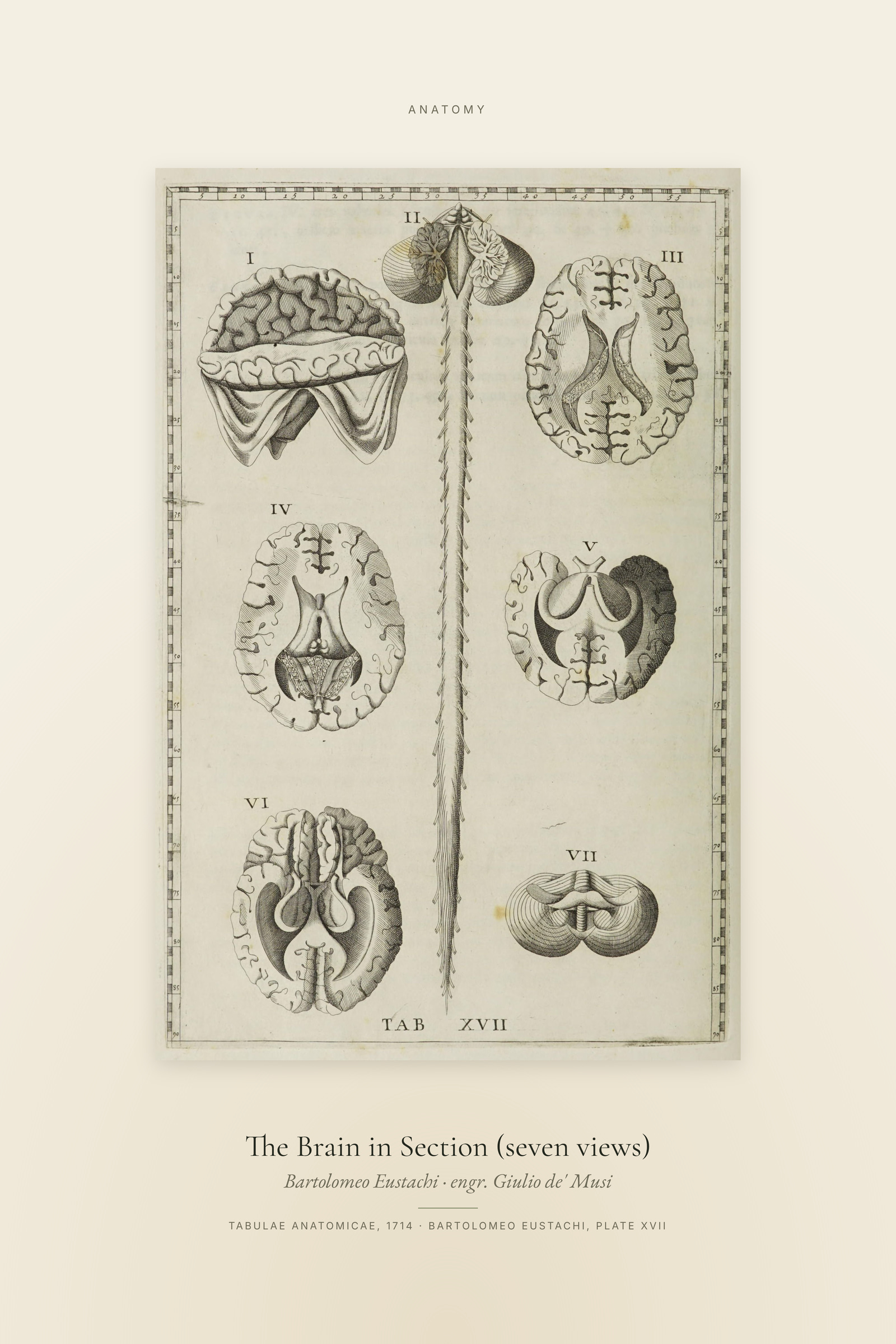 The Brain in Section (seven views) — Specimen