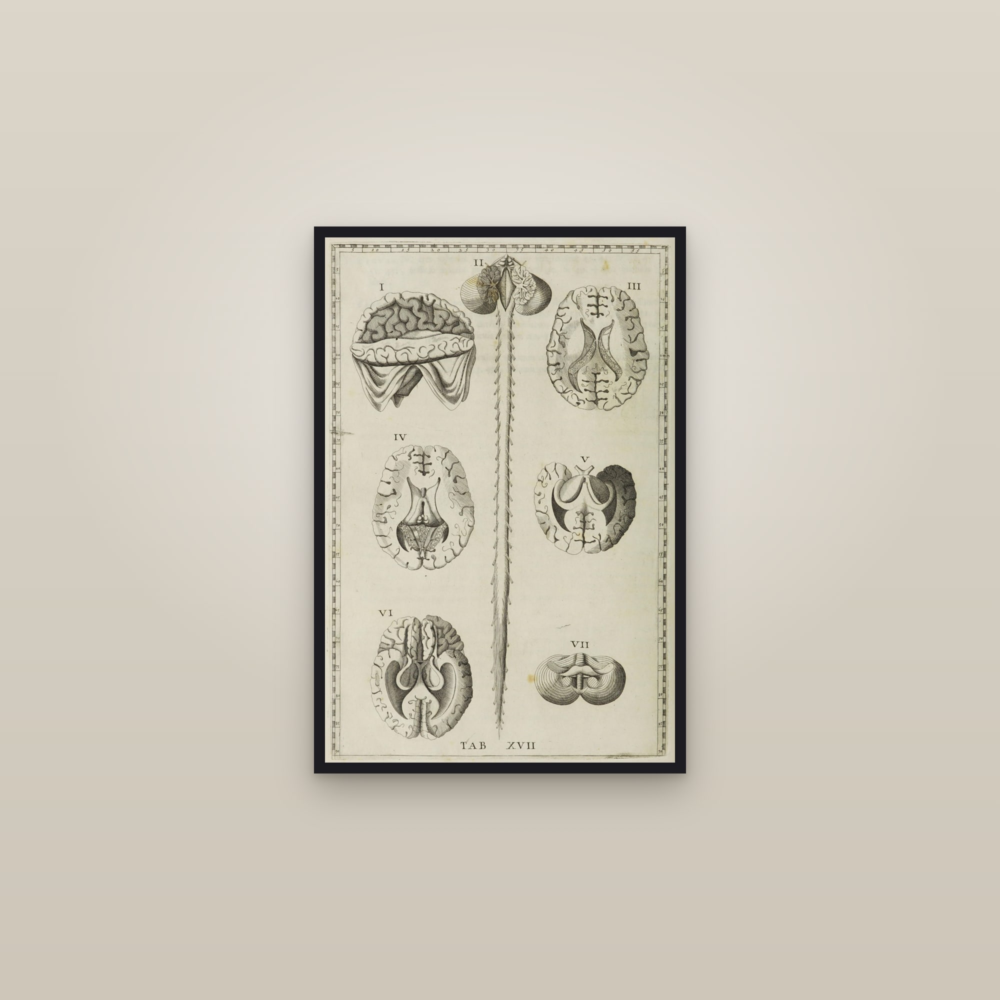 The Brain in Section (seven views) — framed in a gallery setting