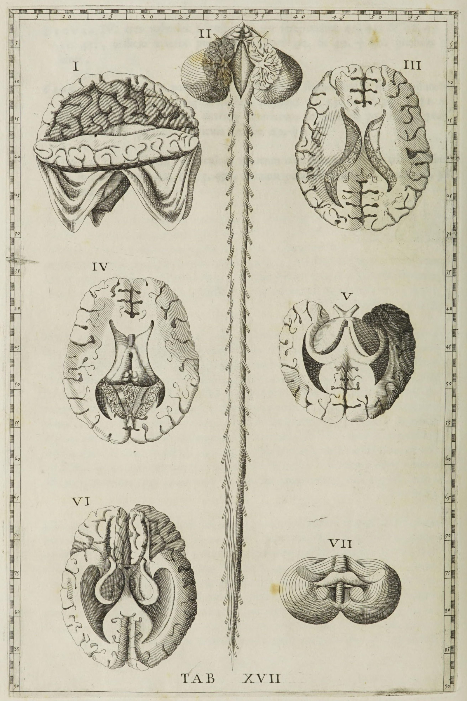 The Brain in Section (seven views)