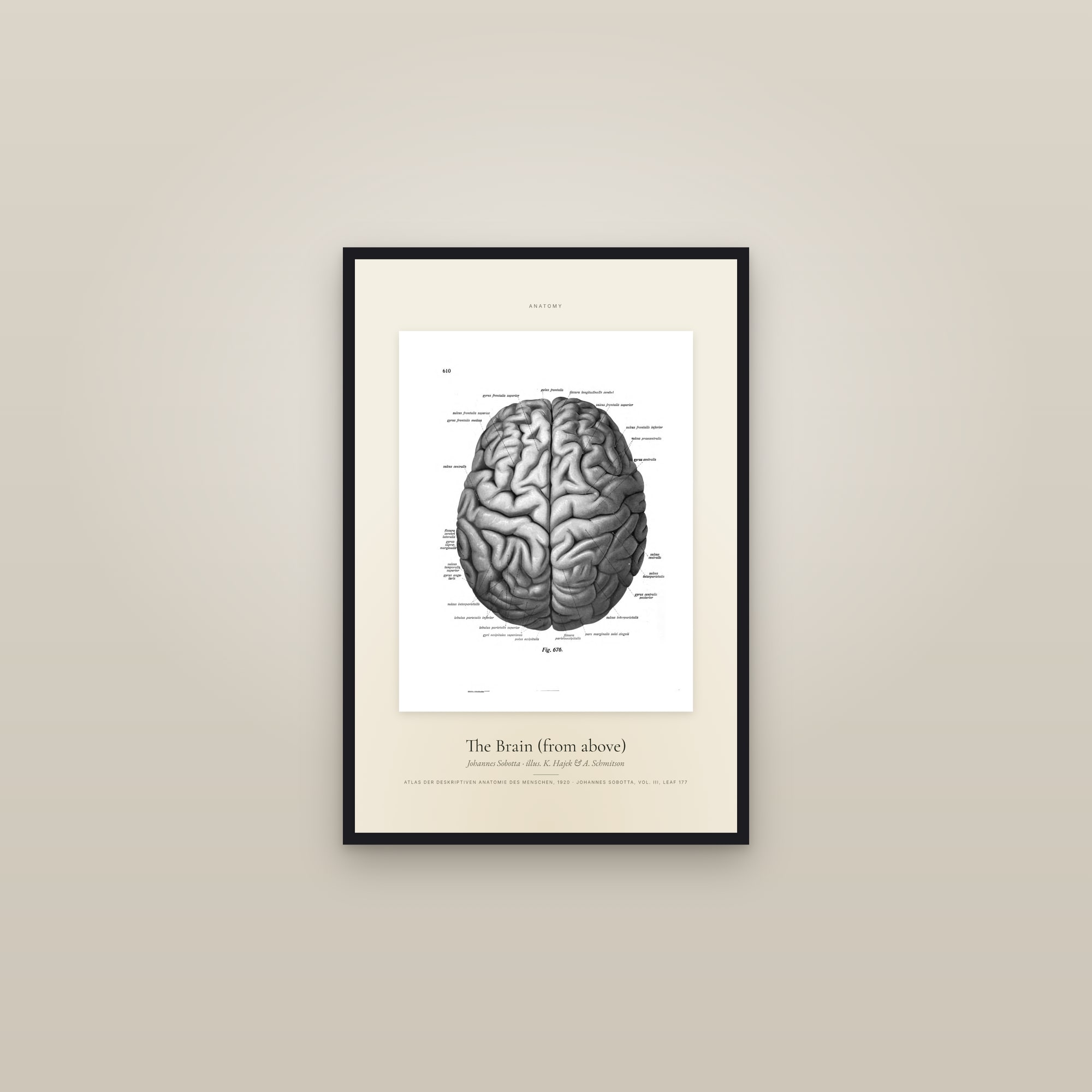 The Brain (from above) — Specimen — framed in a gallery setting