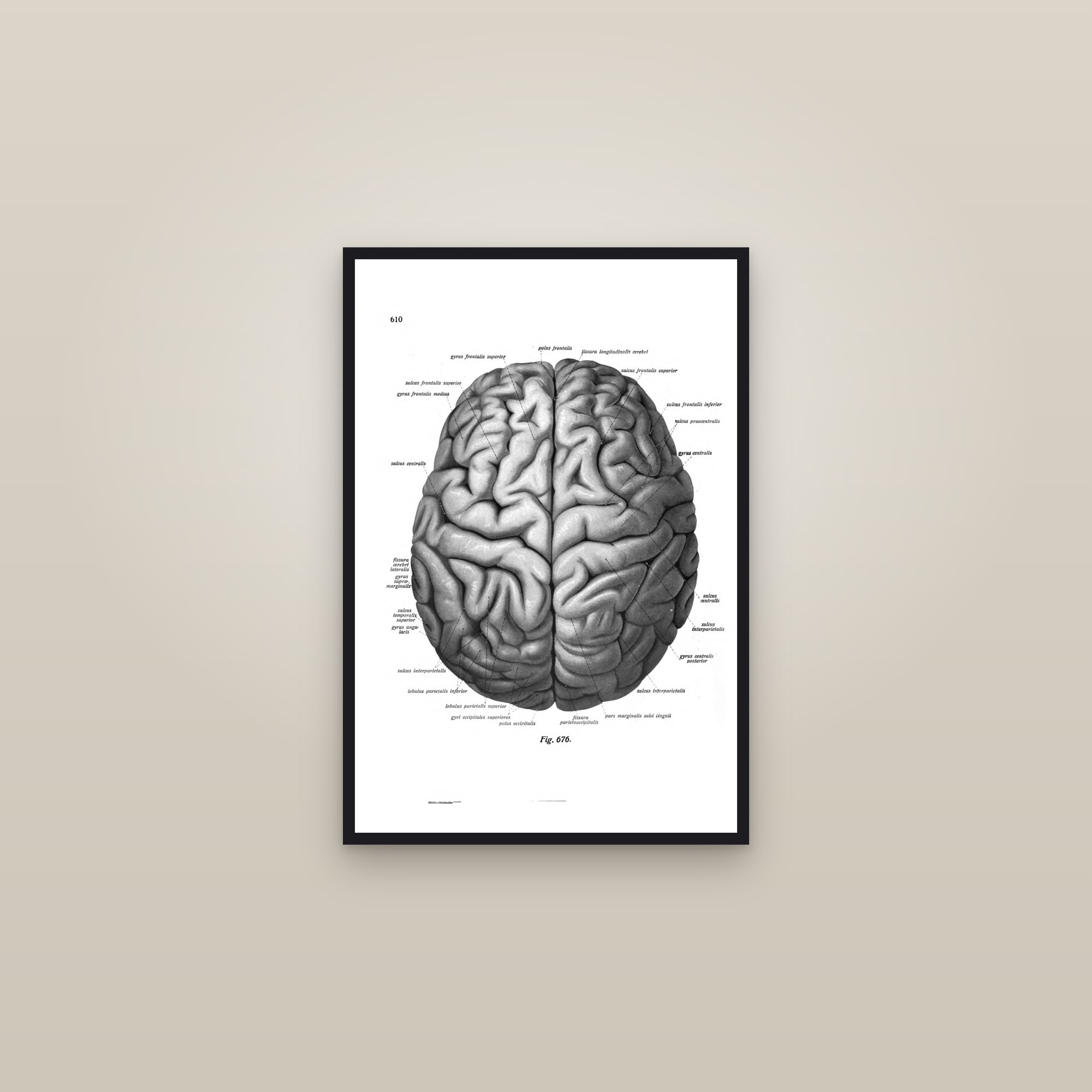 The Brain (from above) — framed in a gallery setting