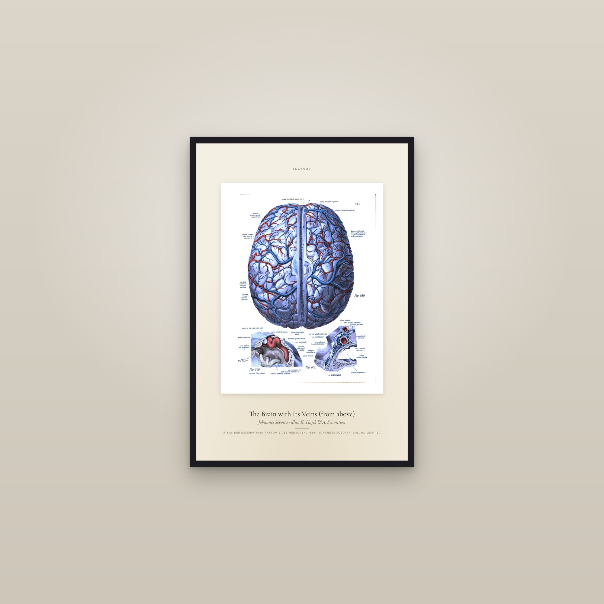 The Brain with Its Veins (from above) — Specimen — framed in a gallery setting