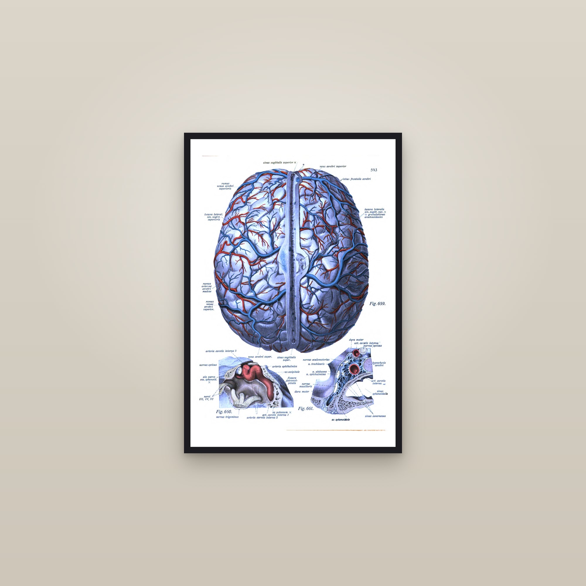 The Brain with Its Veins (from above) — framed in a gallery setting