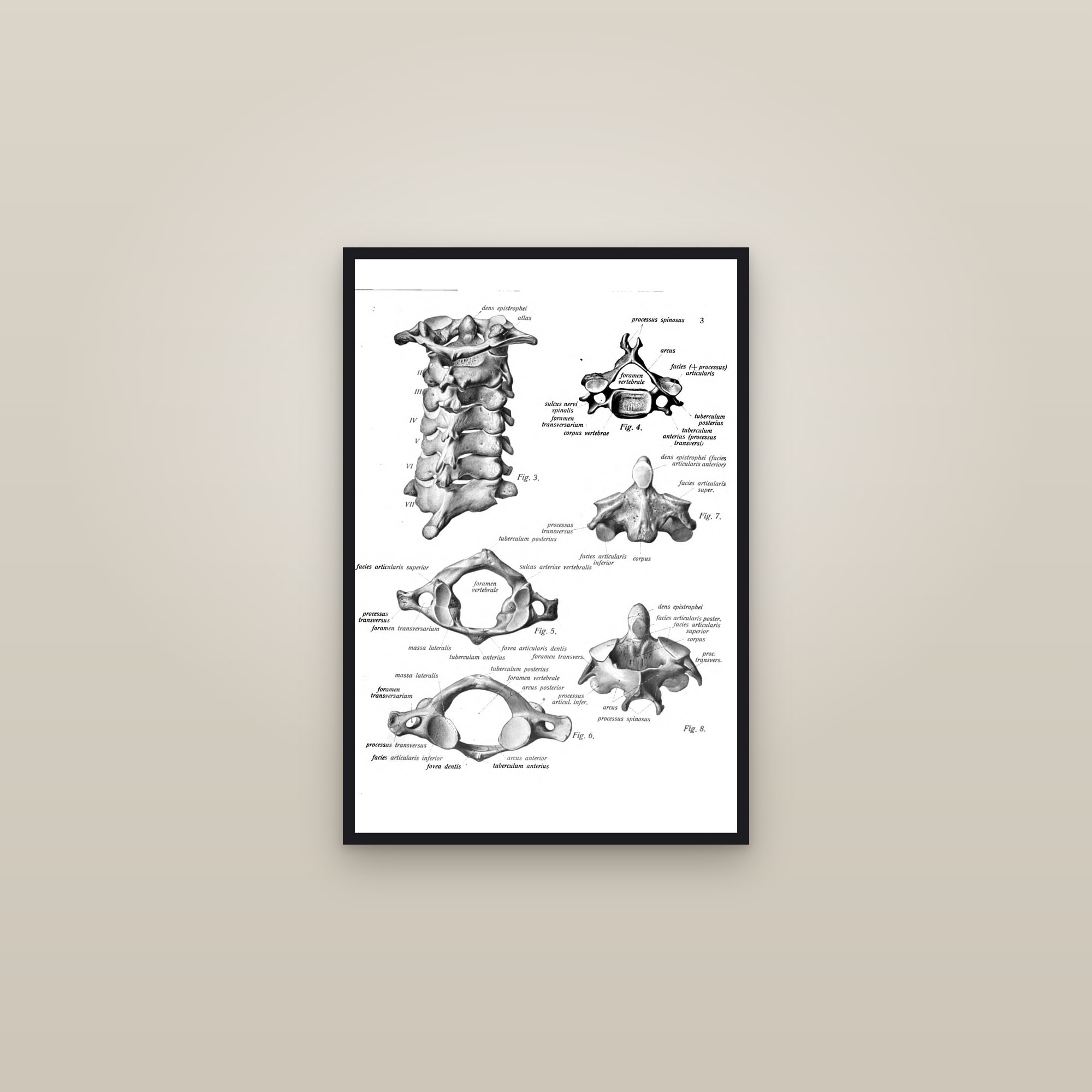 The Cervical Vertebrae (atlas and axis) — framed in a gallery setting