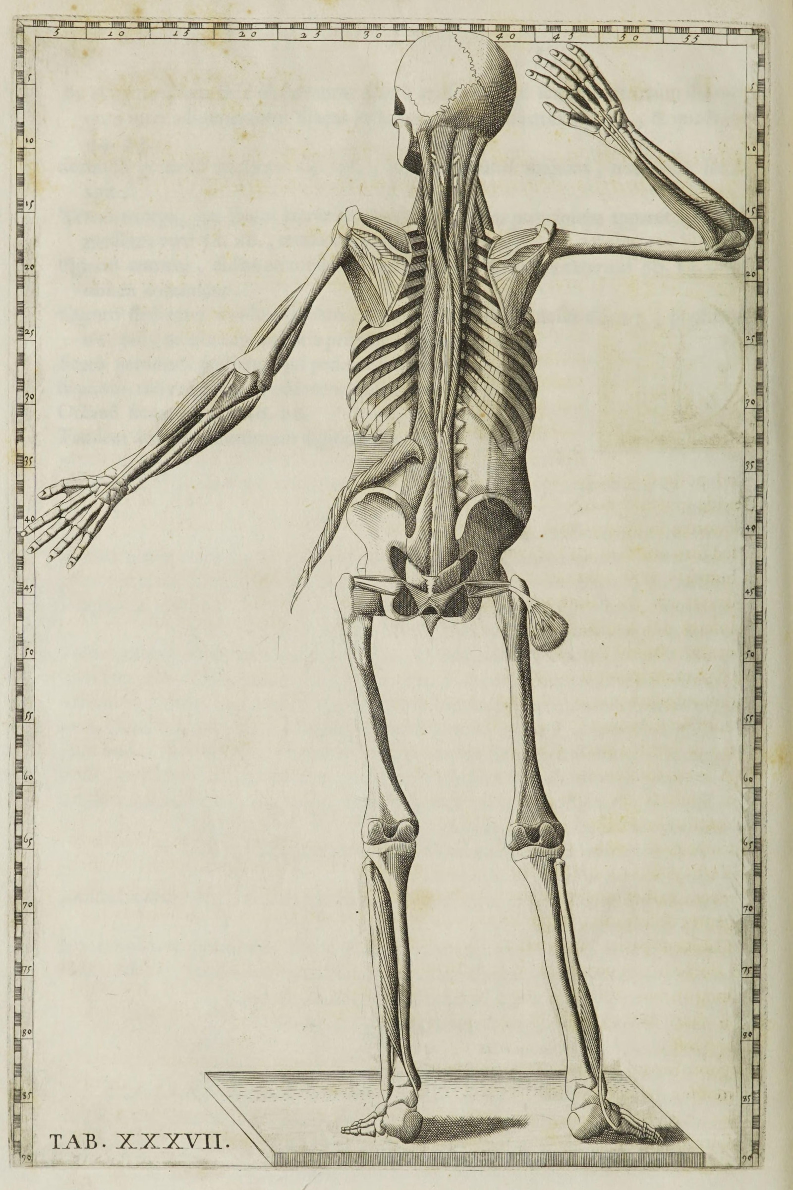 Deep Muscles of the Back (arm raised)