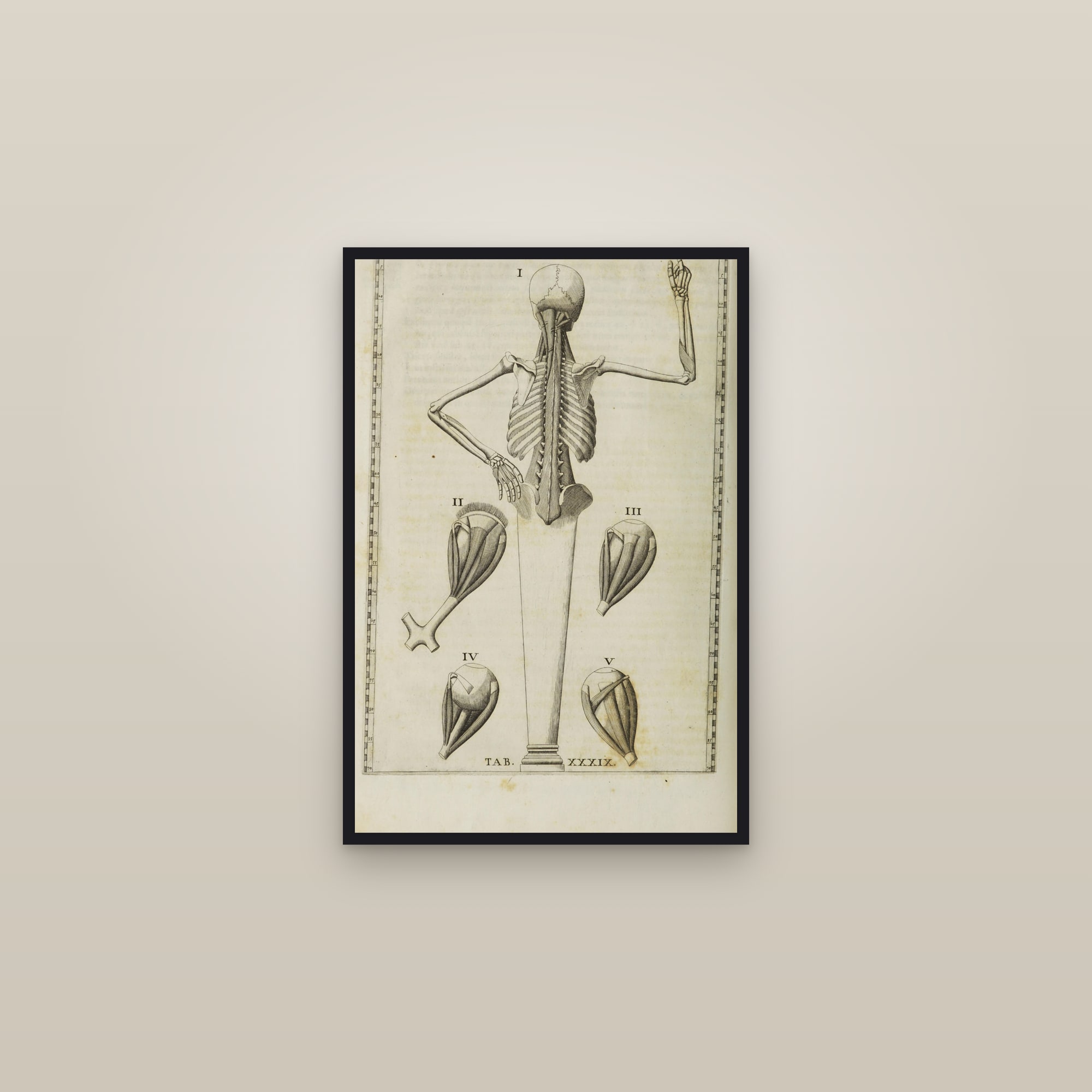 Deep Muscles of the Back (with skeleton) — framed in a gallery setting