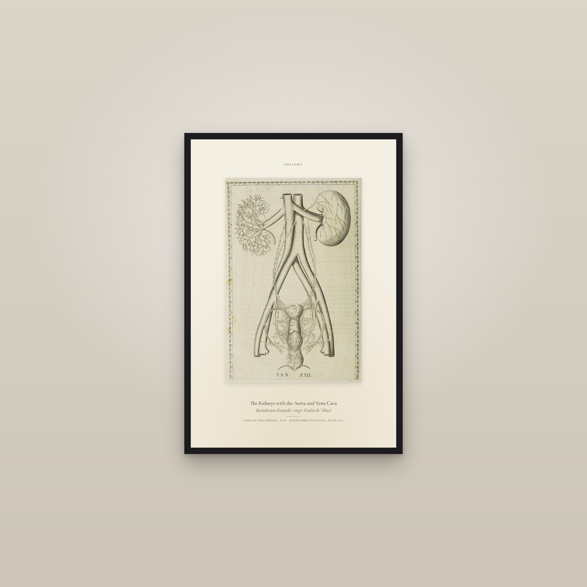 The Kidneys with the Aorta and Vena Cava — Specimen