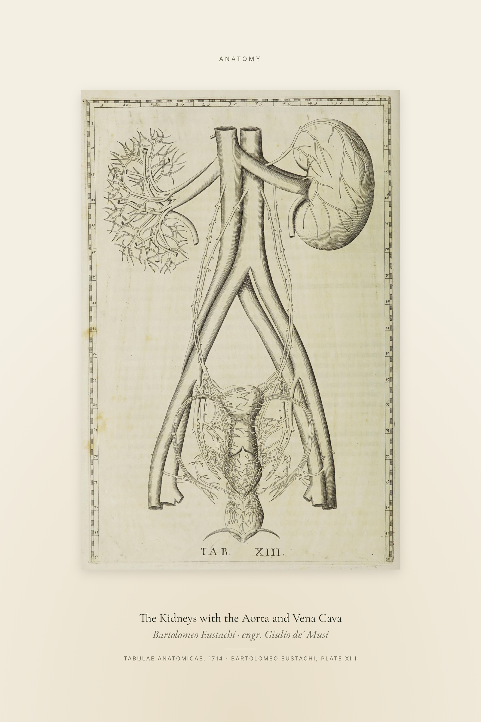The Kidneys with the Aorta and Vena Cava — Specimen