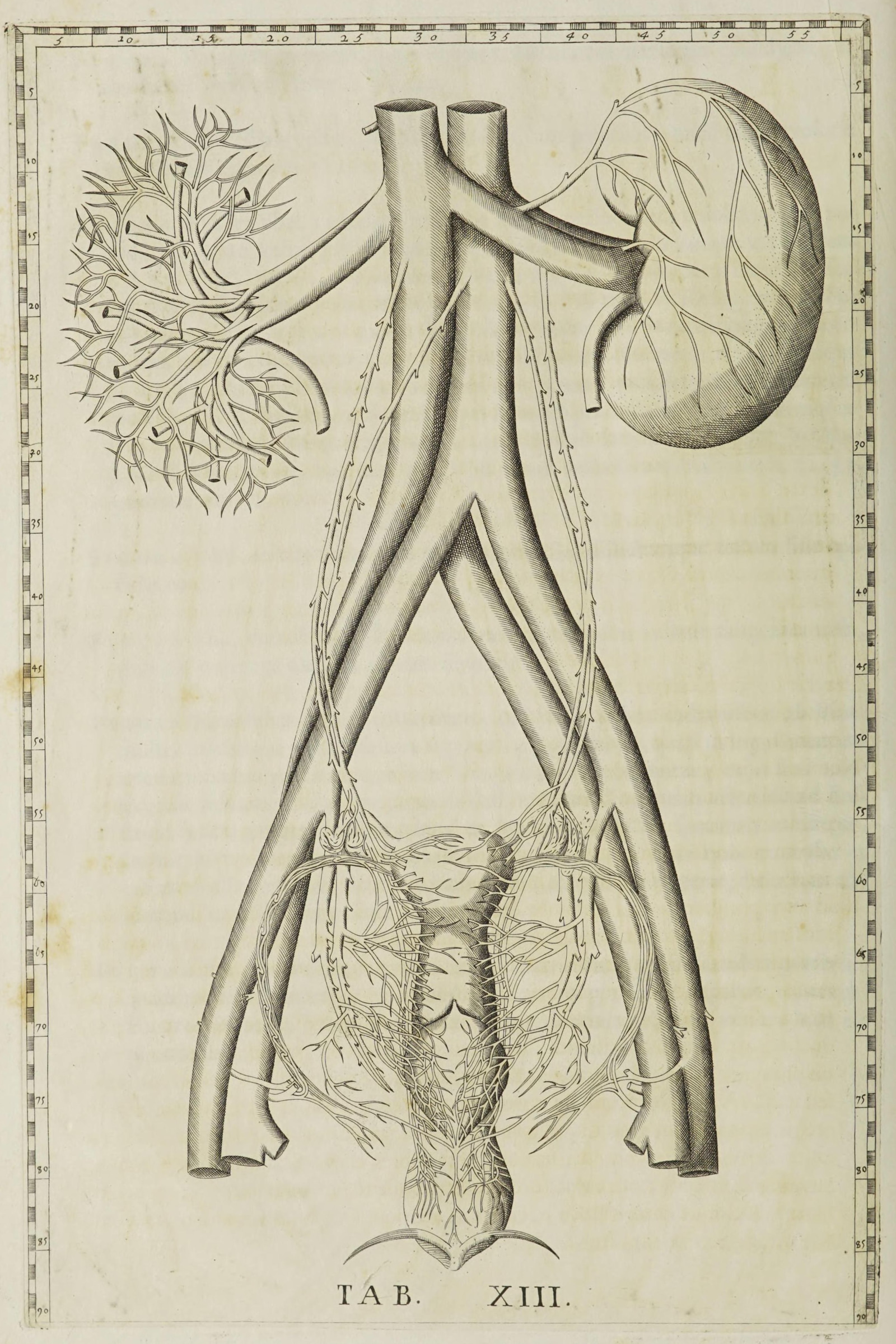 The Kidneys with the Aorta and Vena Cava
