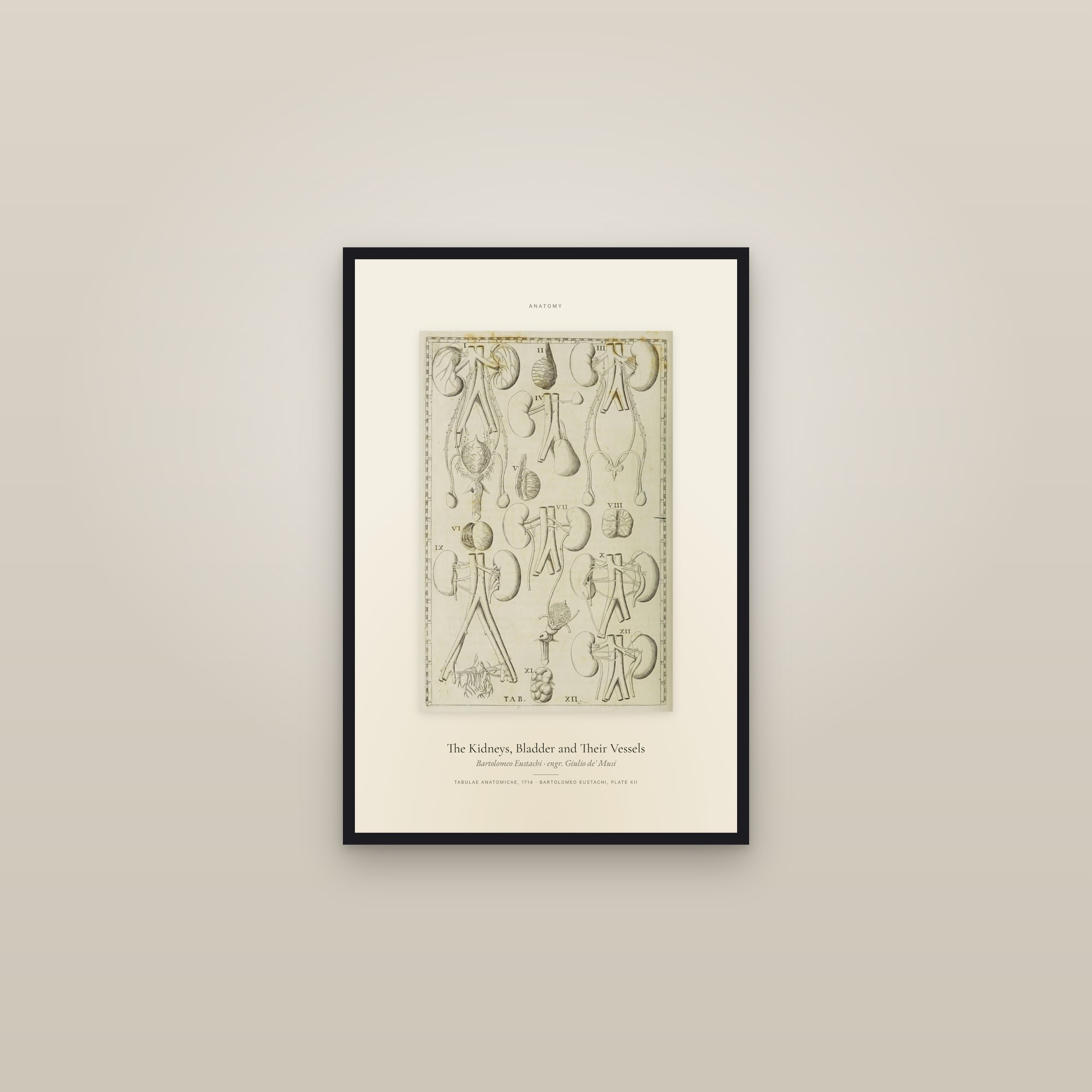 The Kidneys, Bladder and Their Vessels — Specimen — framed in a gallery setting