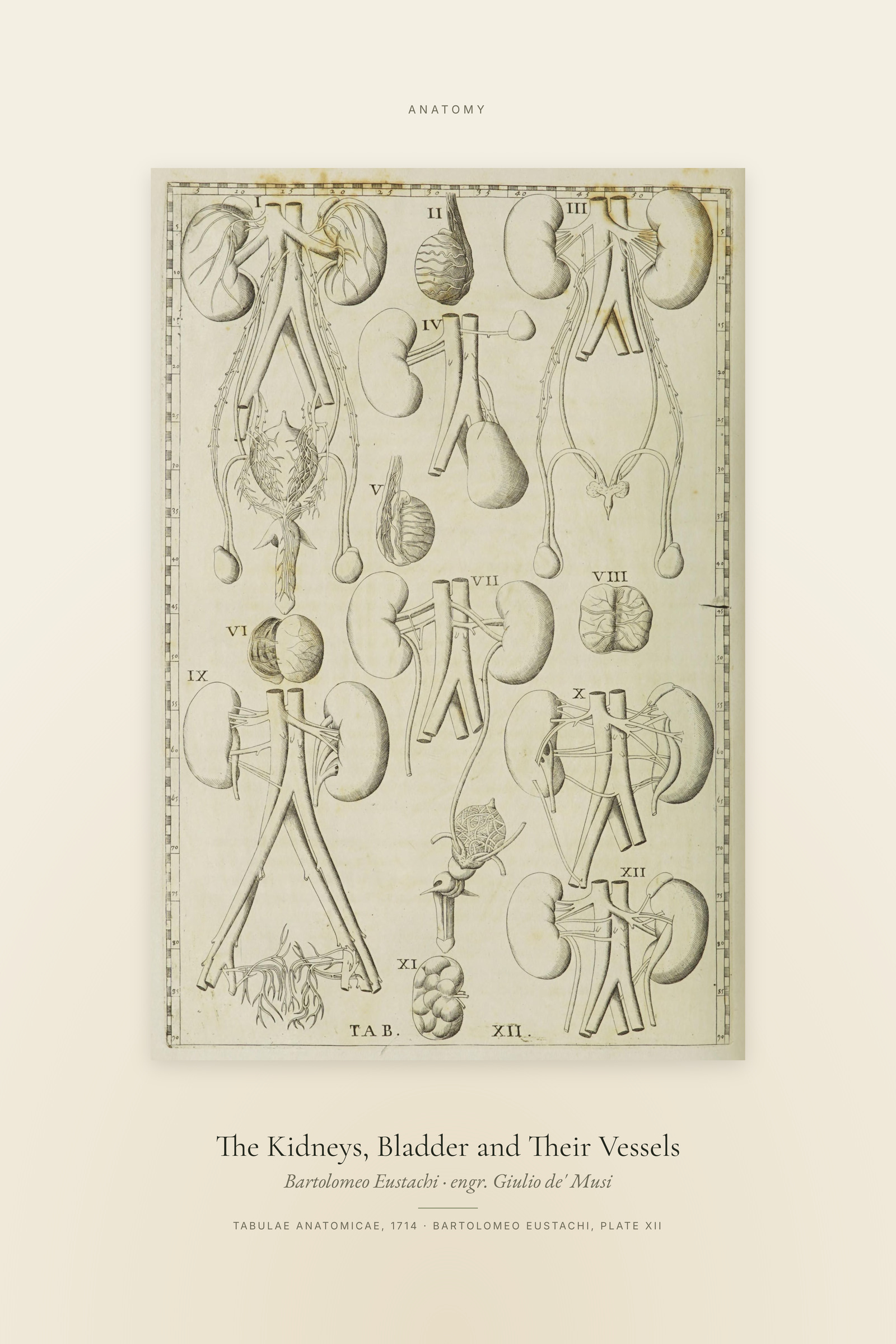 The Kidneys, Bladder and Their Vessels — Specimen