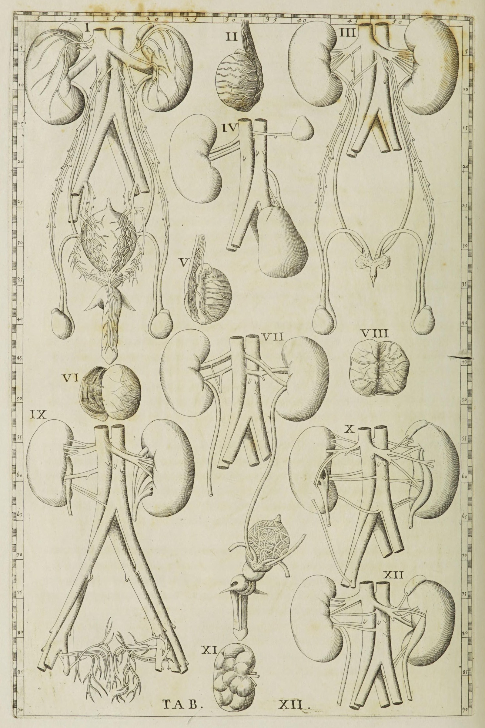 The Kidneys, Bladder and Their Vessels