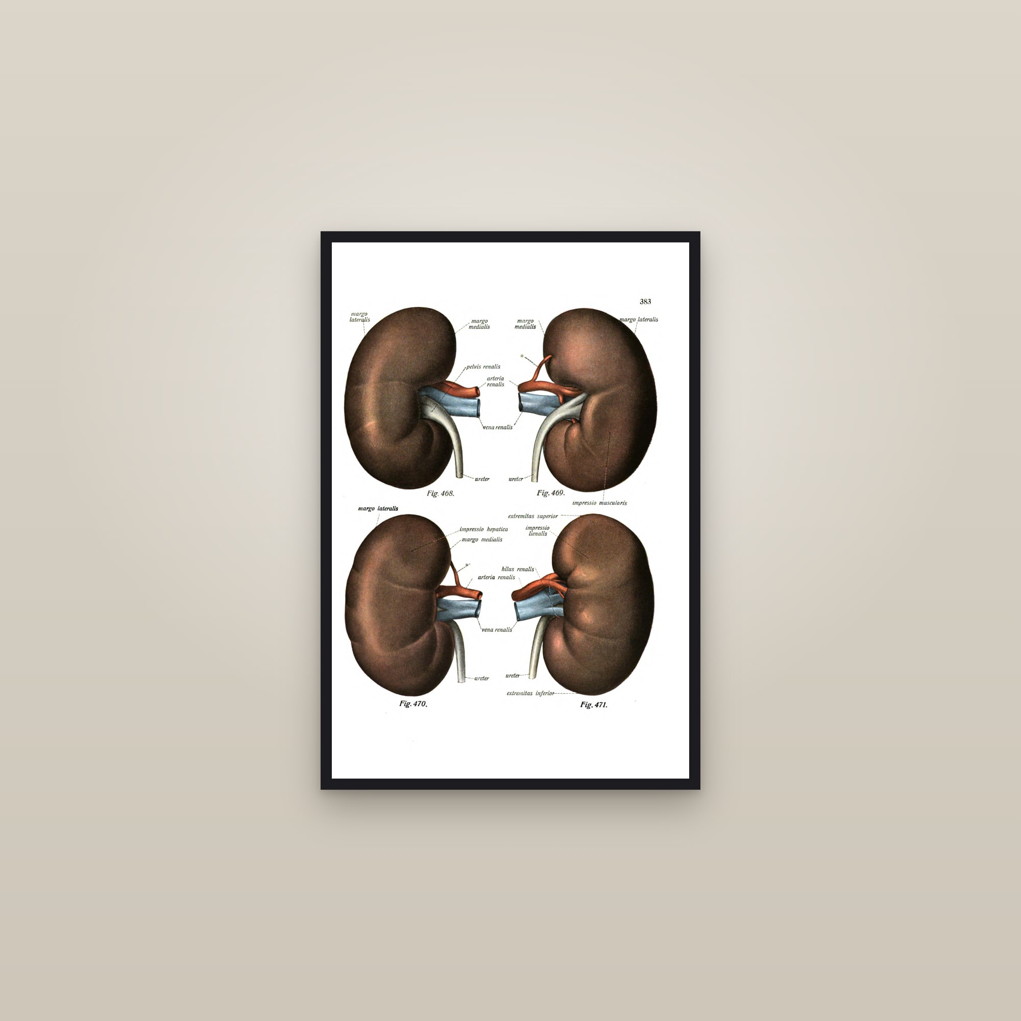 The Kidneys (front and back) — framed in a gallery setting