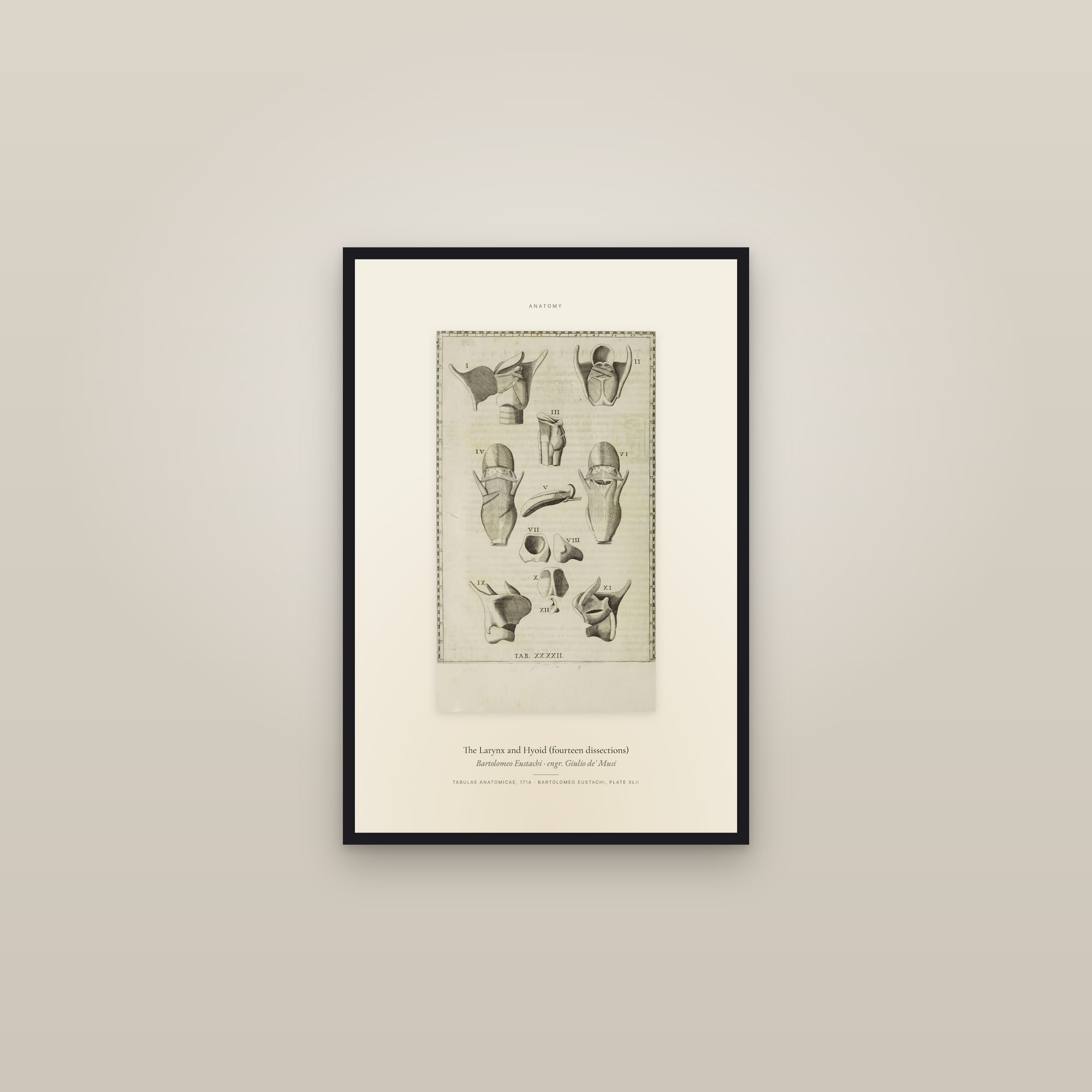 The Larynx and Hyoid (fourteen dissections) — Specimen — framed in a gallery setting