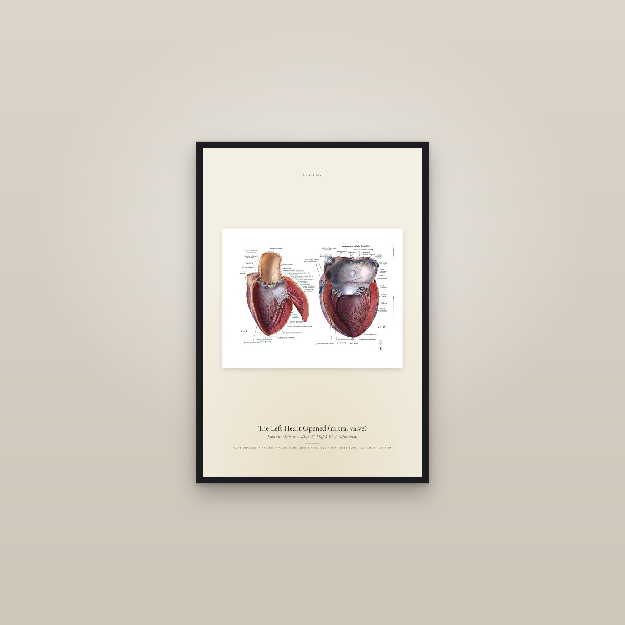 The Left Heart Opened (mitral valve) — framed in a gallery setting