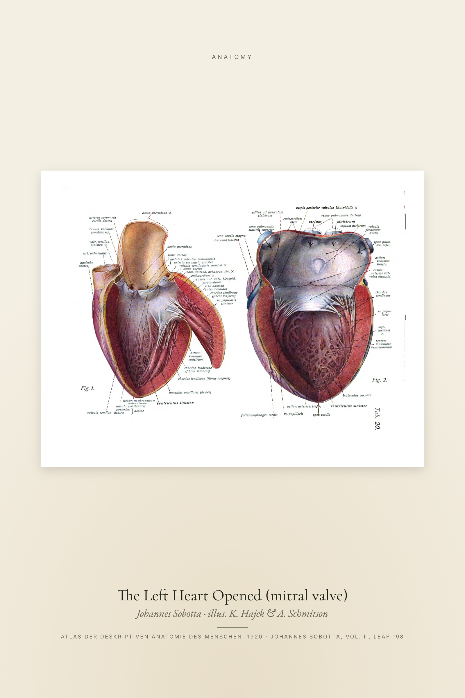 The Left Heart Opened (mitral valve)