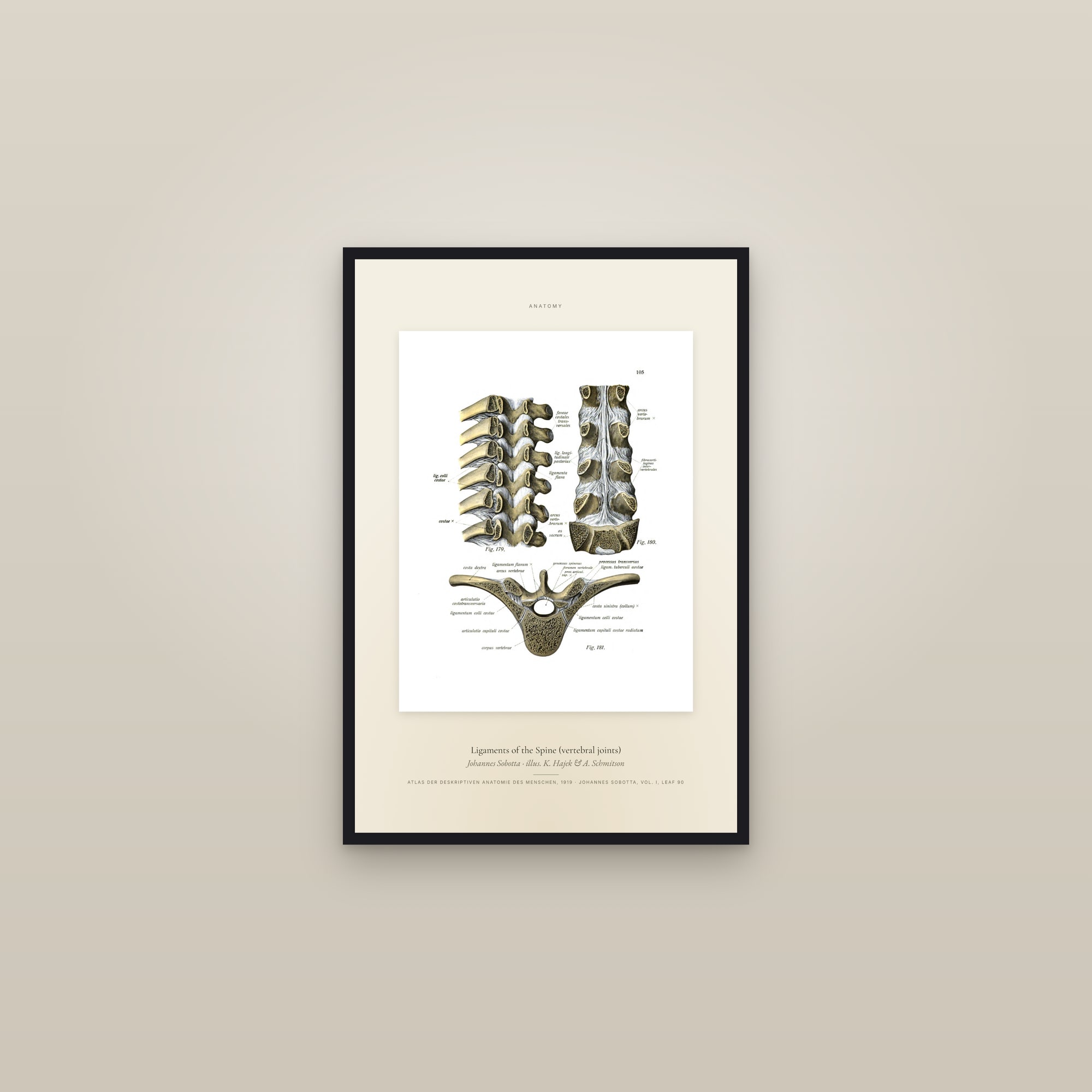 Ligaments of the Spine (vertebral joints) — Specimen — framed in a gallery setting