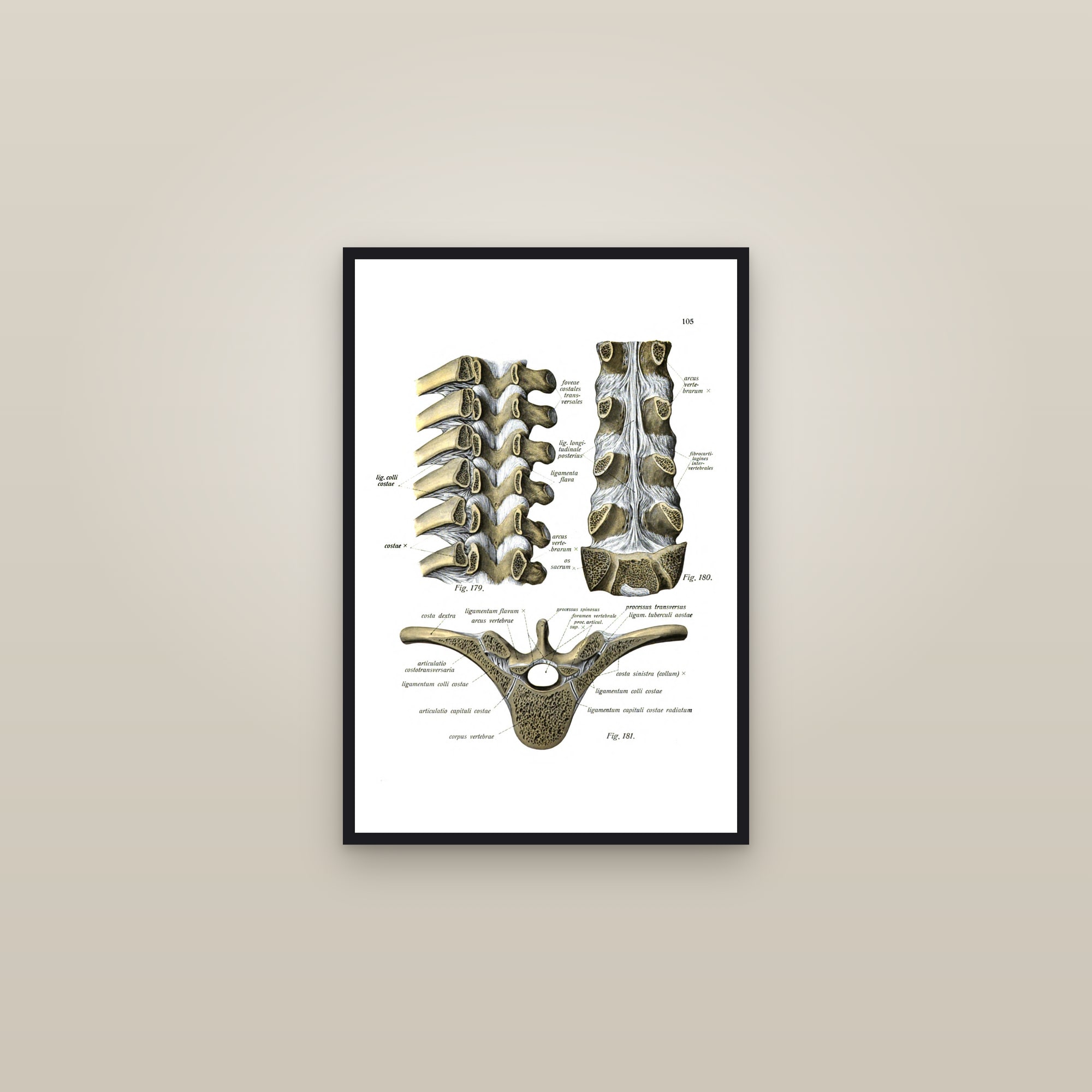 Ligaments of the Spine (vertebral joints) — framed in a gallery setting