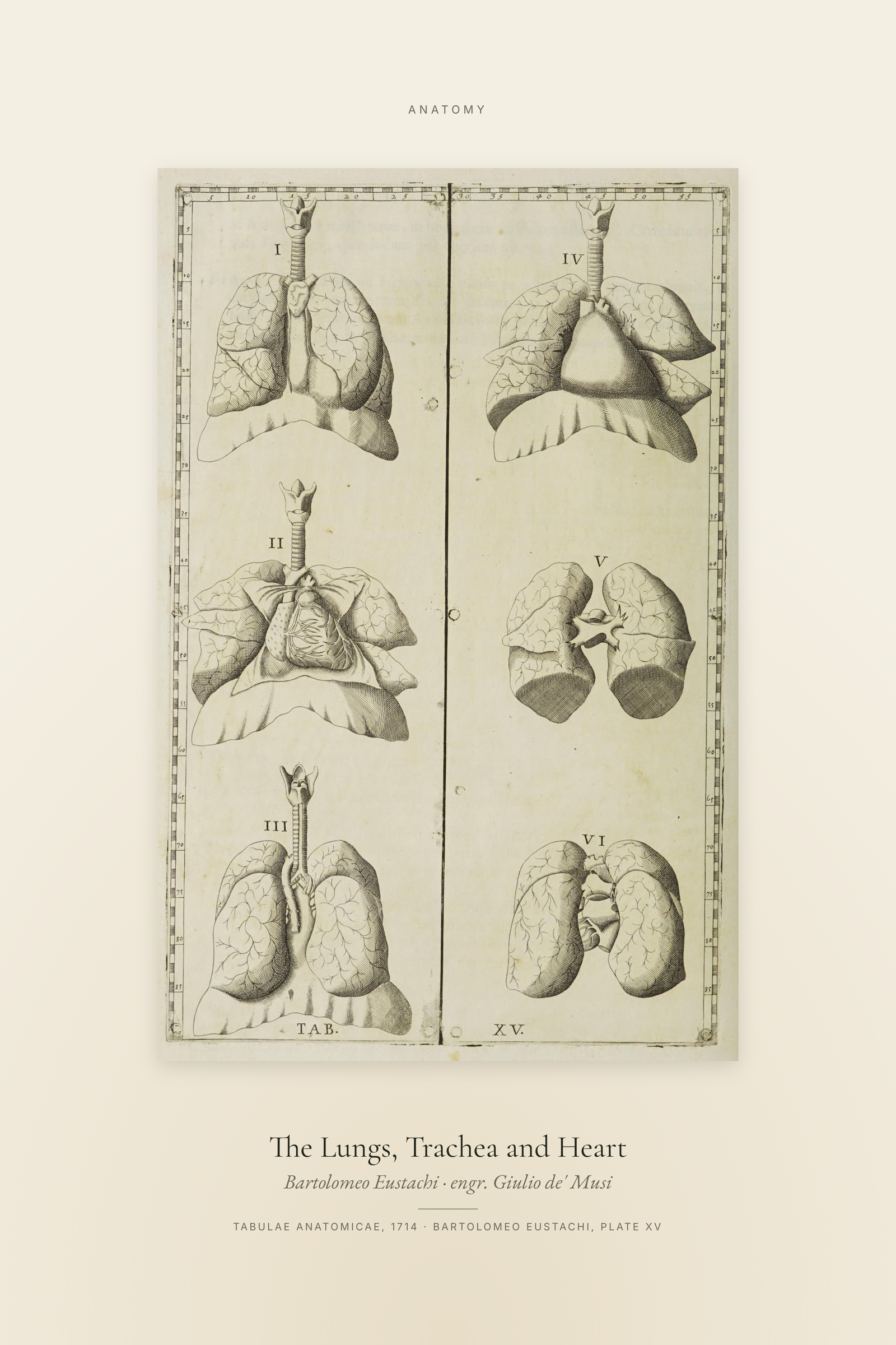 The Lungs, Trachea and Heart — Specimen