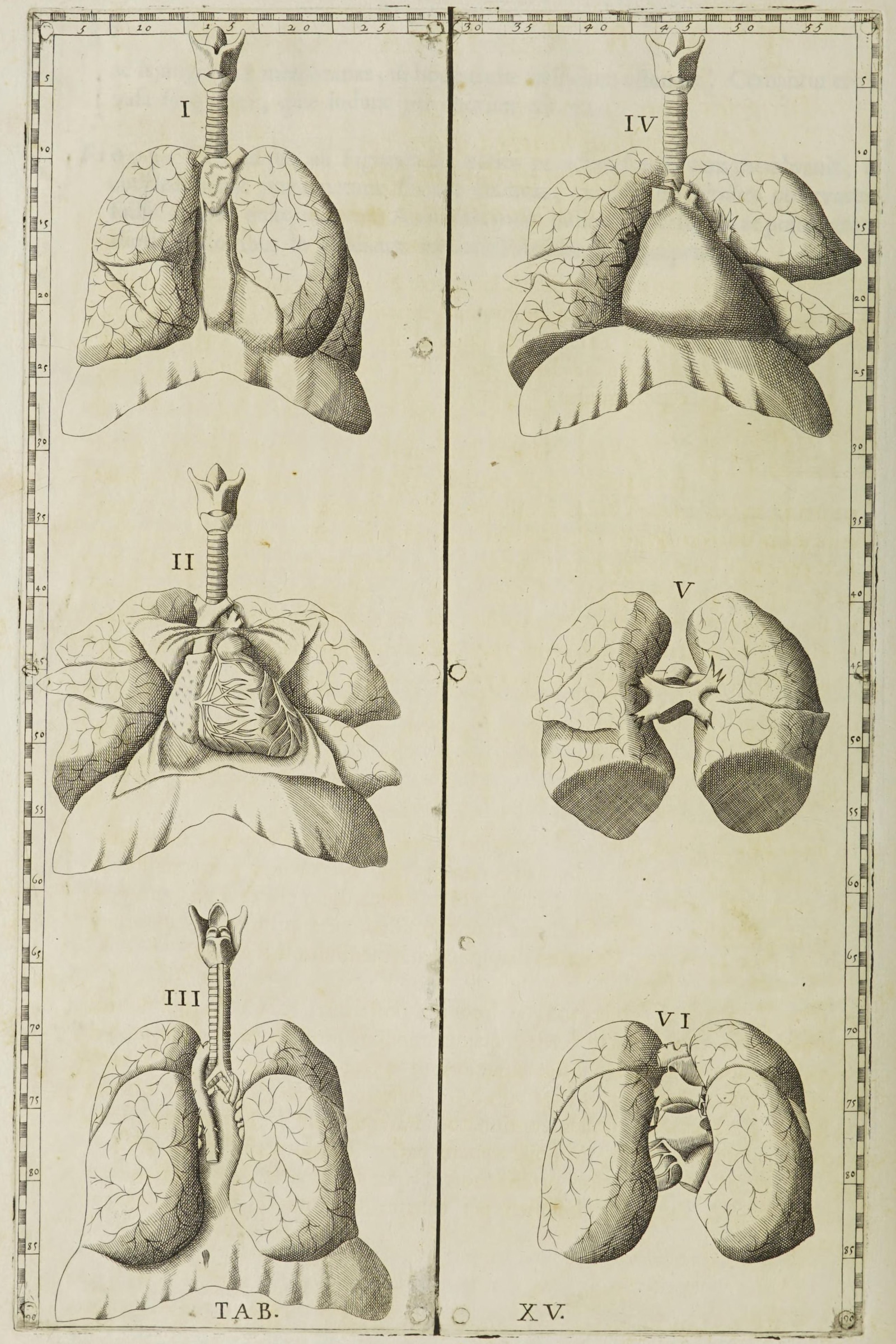 The Lungs, Trachea and Heart