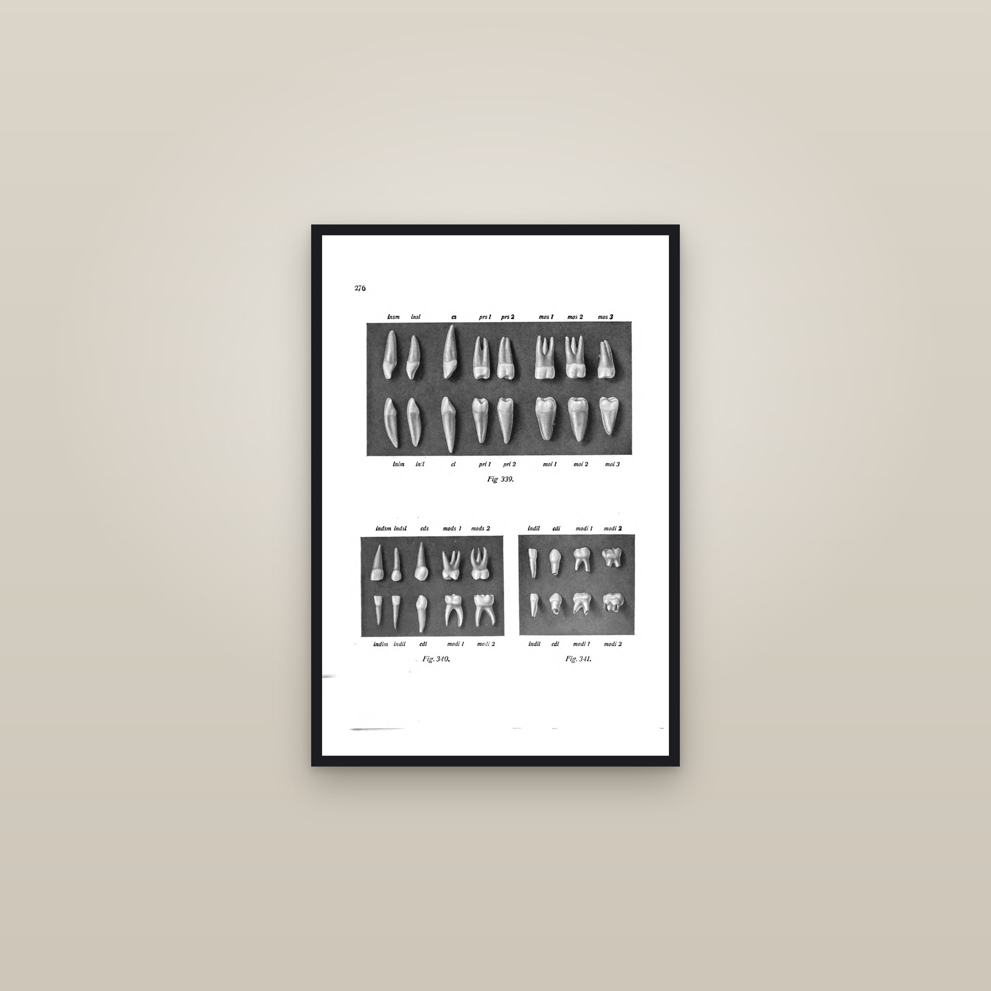The Milk Teeth and Permanent Teeth — framed in a gallery setting