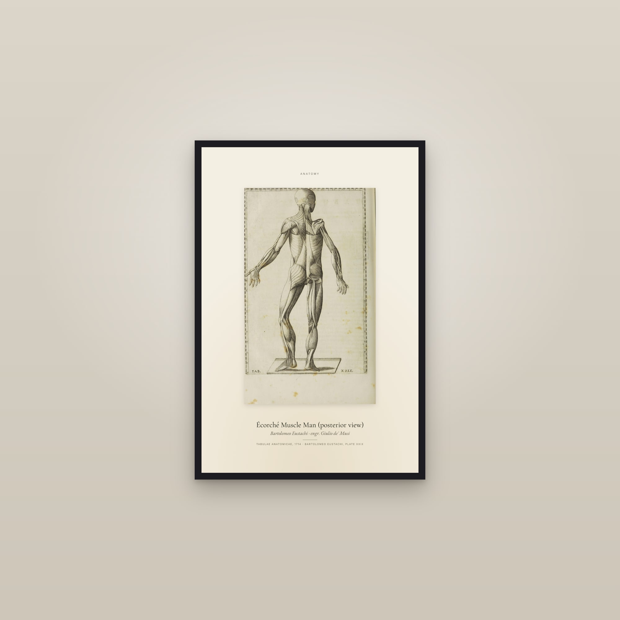 Écorché Muscle Man (posterior view) — Specimen — framed in a gallery setting