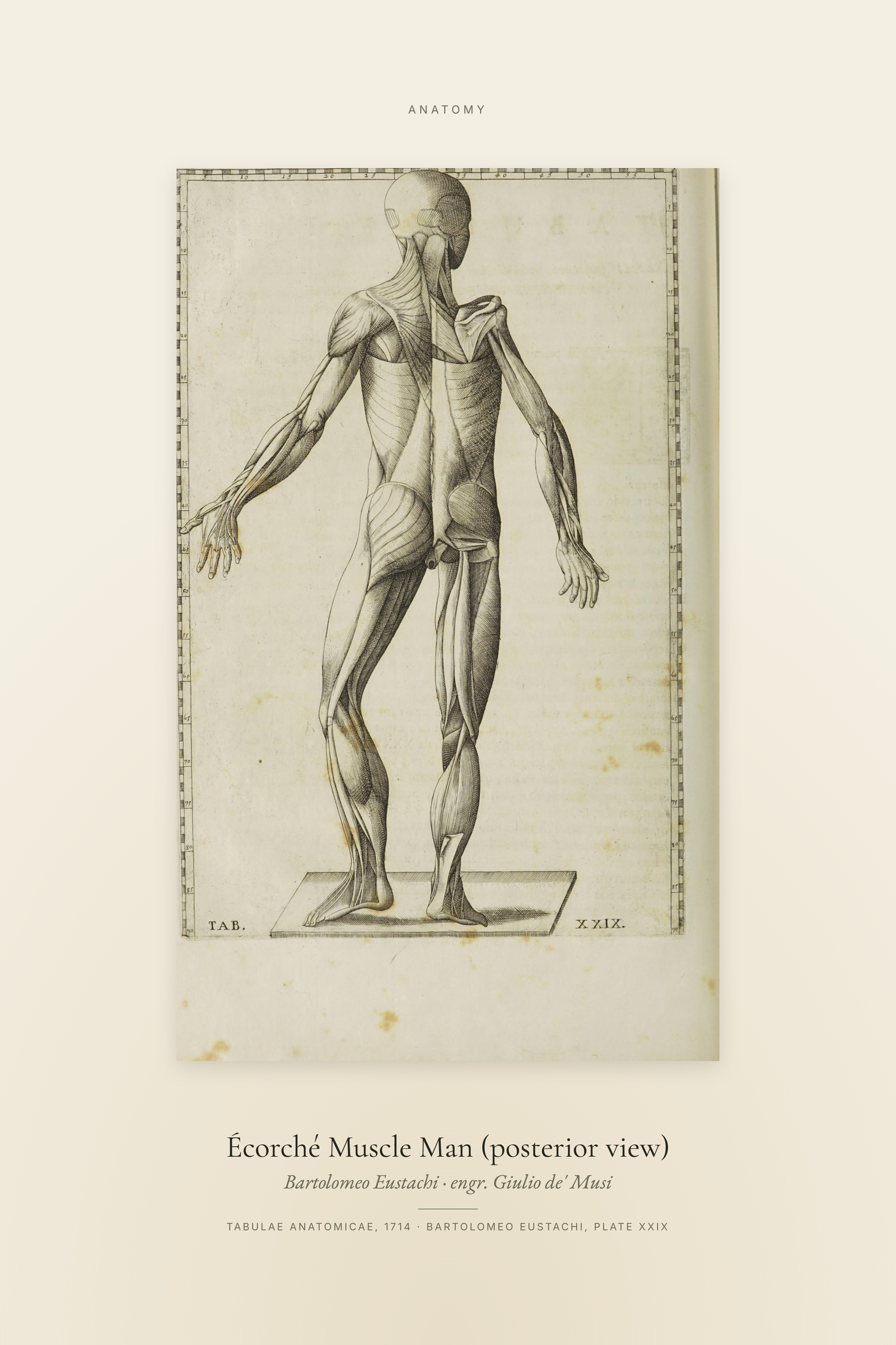 Écorché Muscle Man (posterior view) — Specimen