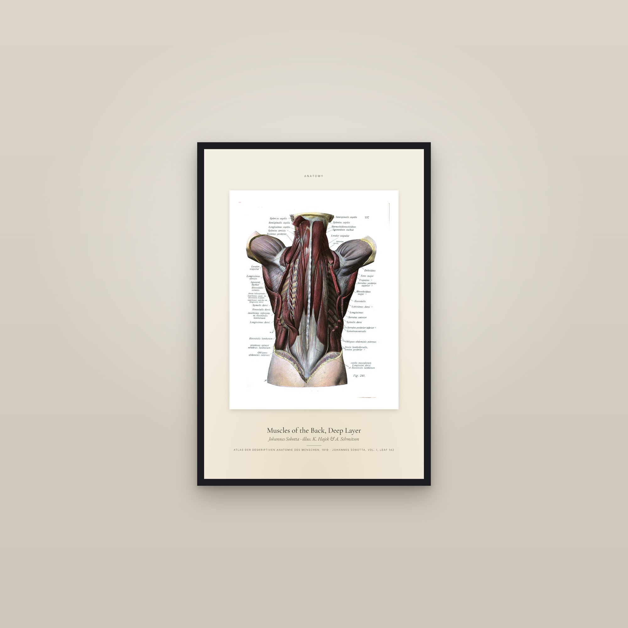 Muscles of the Back, Deep Layer — Specimen — framed in a gallery setting