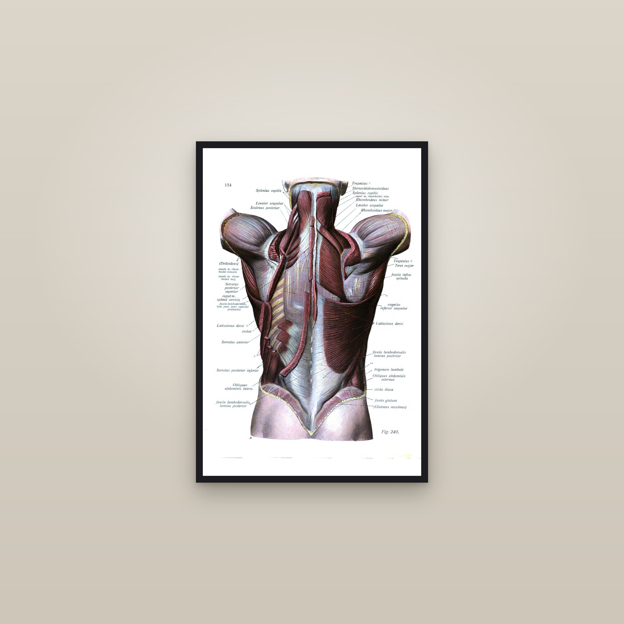 Muscles of the Back, Second Layer — framed in a gallery setting