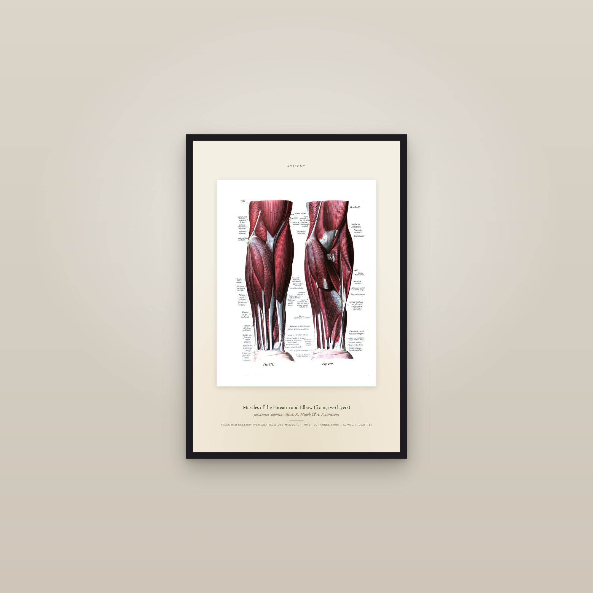 Muscles of the Forearm and Elbow (front, two layers) — Specimen — framed in a gallery setting