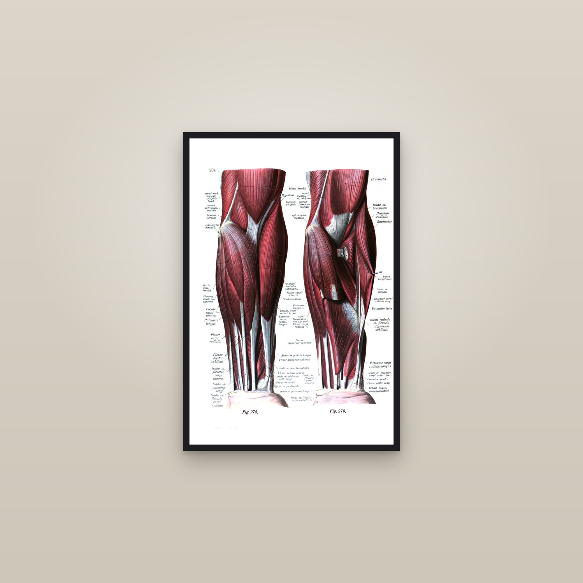 Muscles of the Forearm and Elbow (front, two layers) — framed in a gallery setting