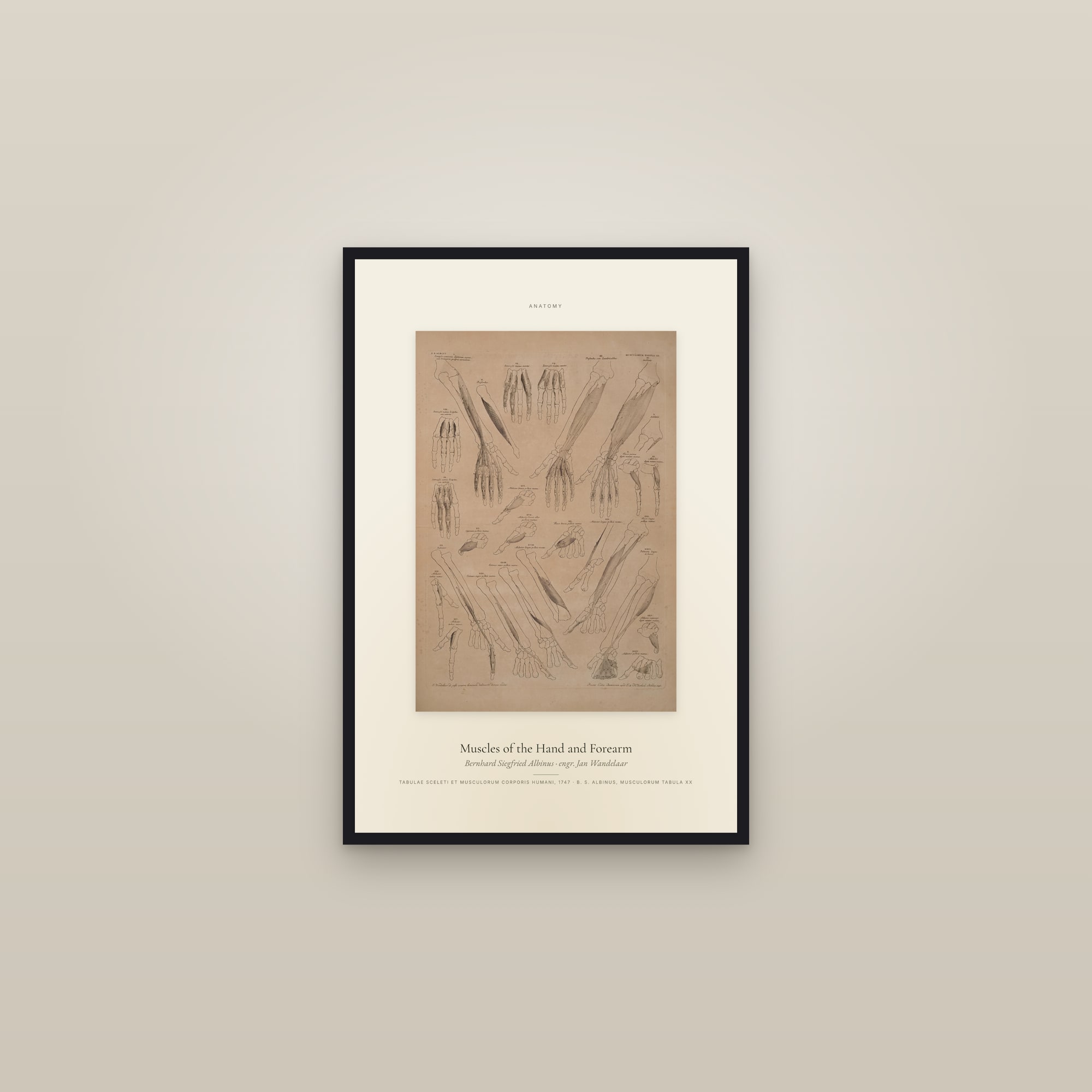Muscles of the Hand and Forearm — Specimen — framed in a gallery setting