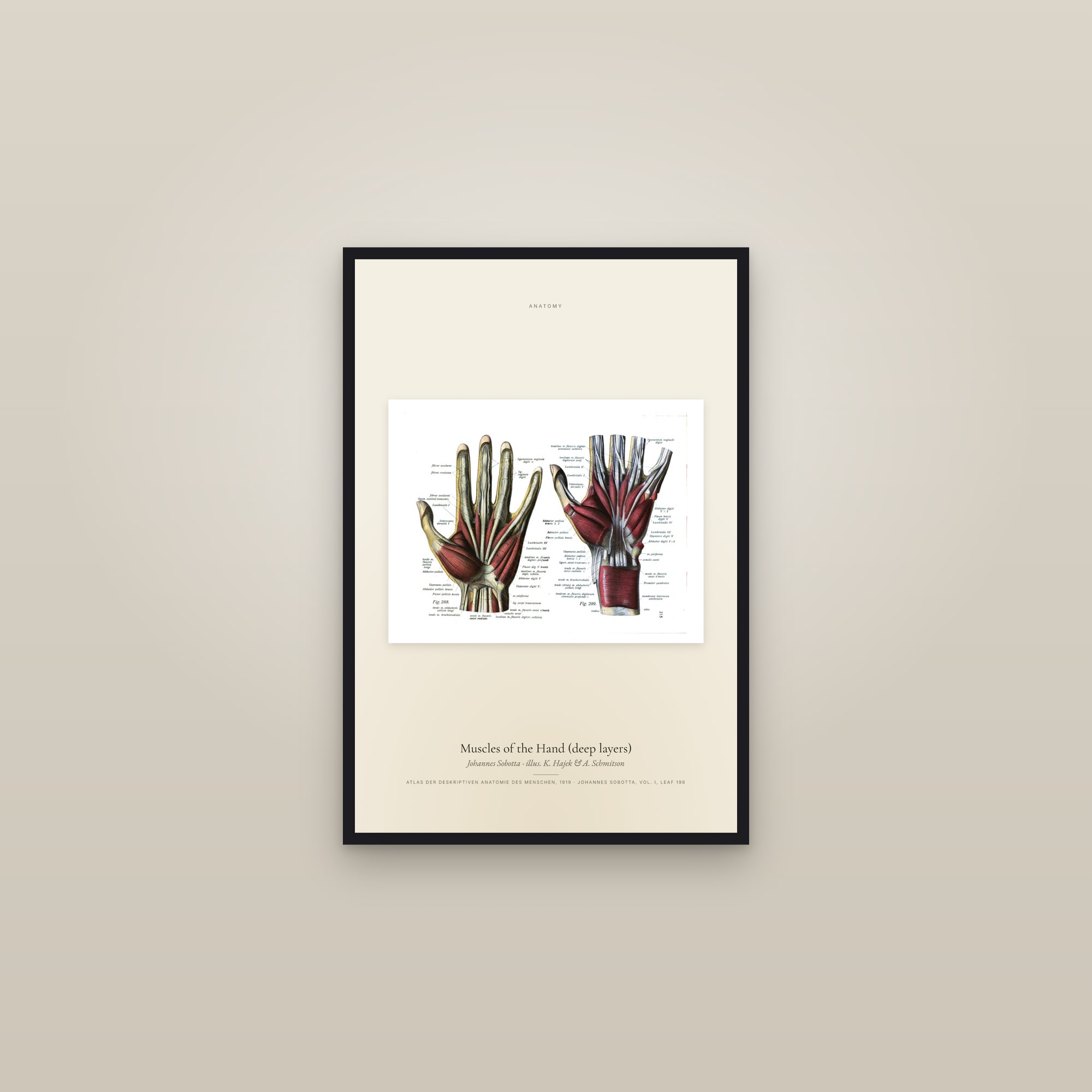 Muscles of the Hand (deep layers) — framed in a gallery setting