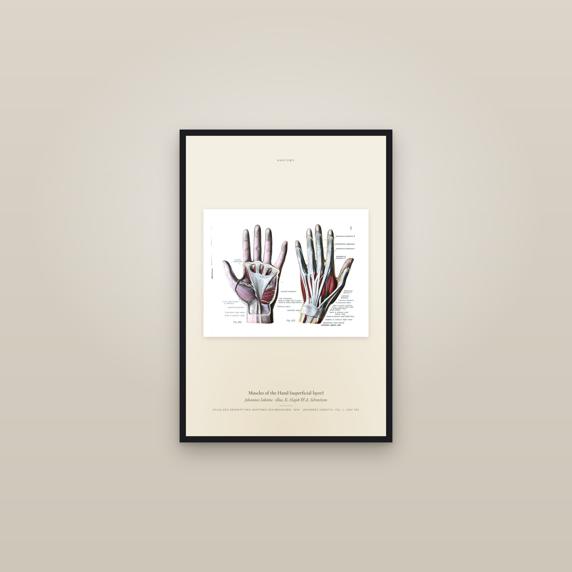 Muscles of the Hand (superficial layer) — framed in a gallery setting
