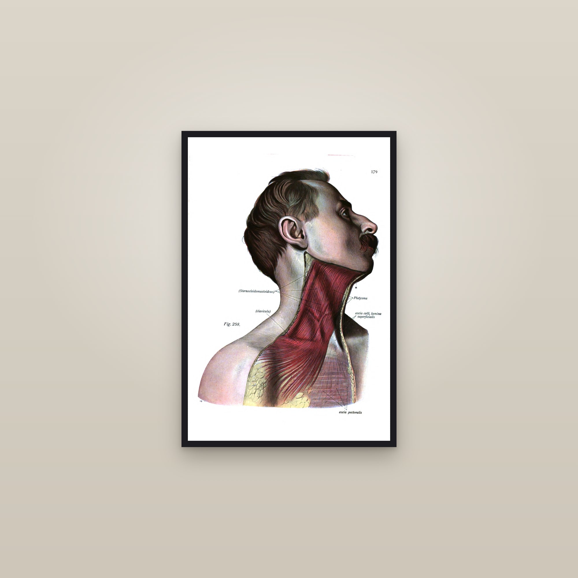 Muscles of the Head and Neck (side view) — framed in a gallery setting