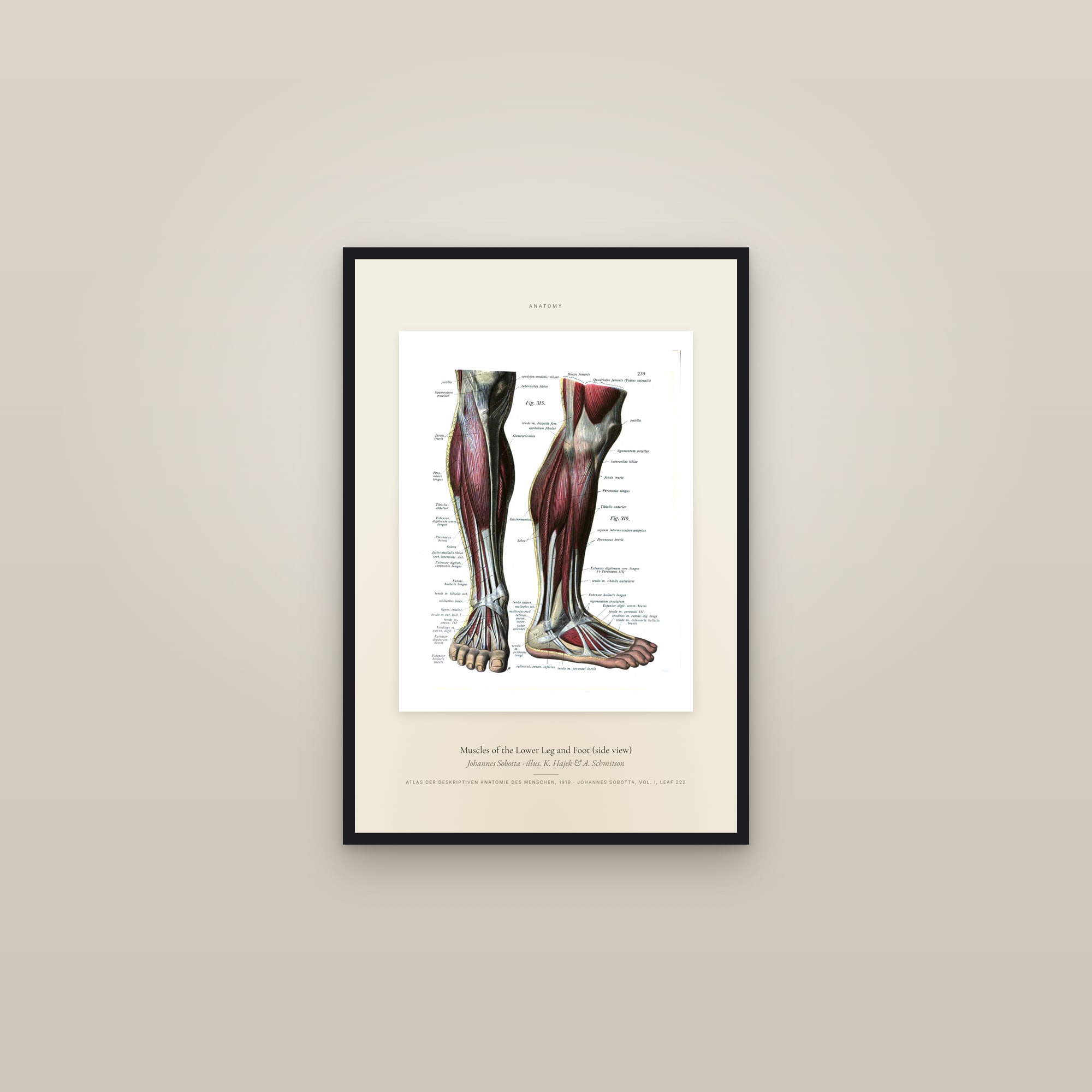 Muscles of the Lower Leg and Foot (side view) — Specimen — framed in a gallery setting