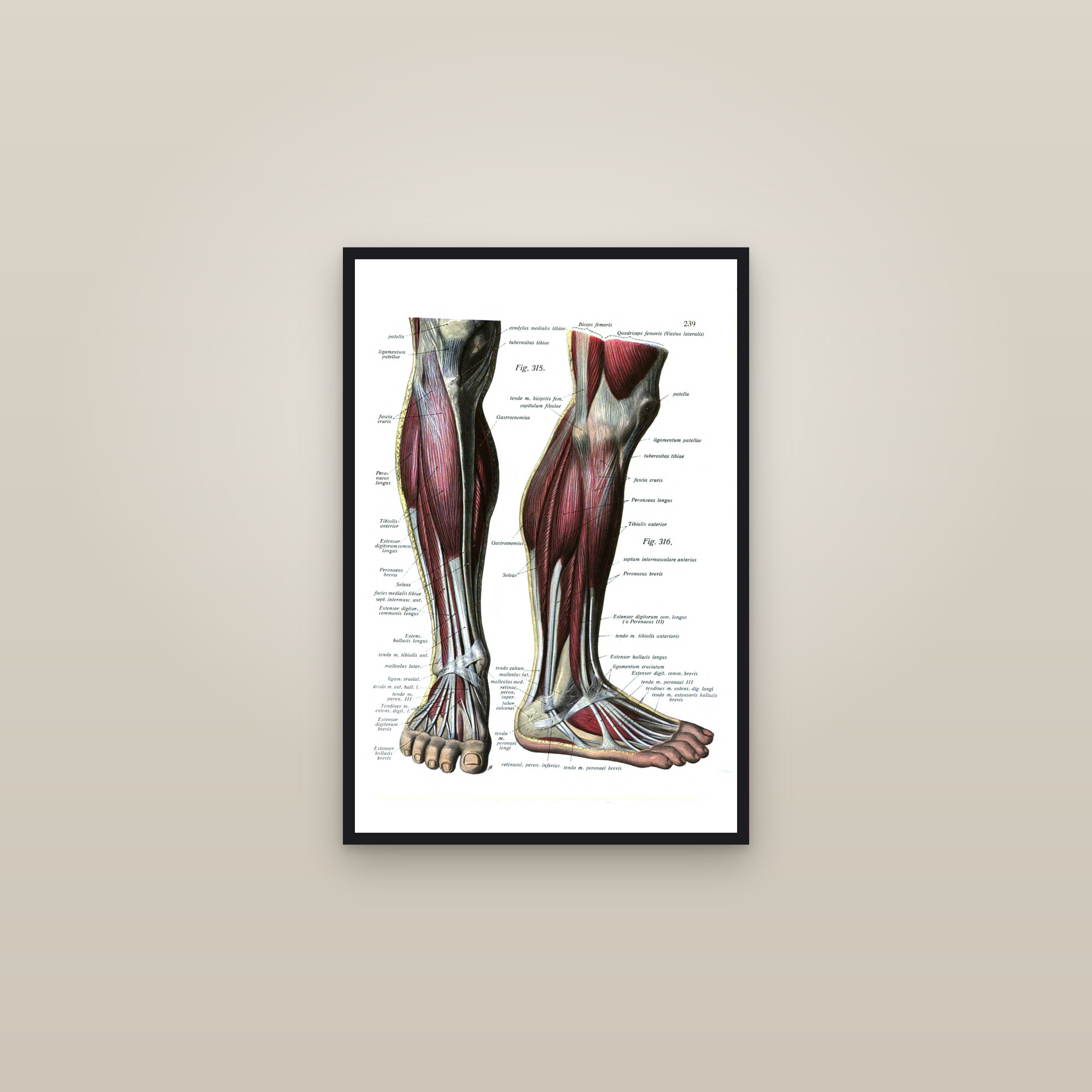 Muscles of the Lower Leg and Foot (side view) — framed in a gallery setting