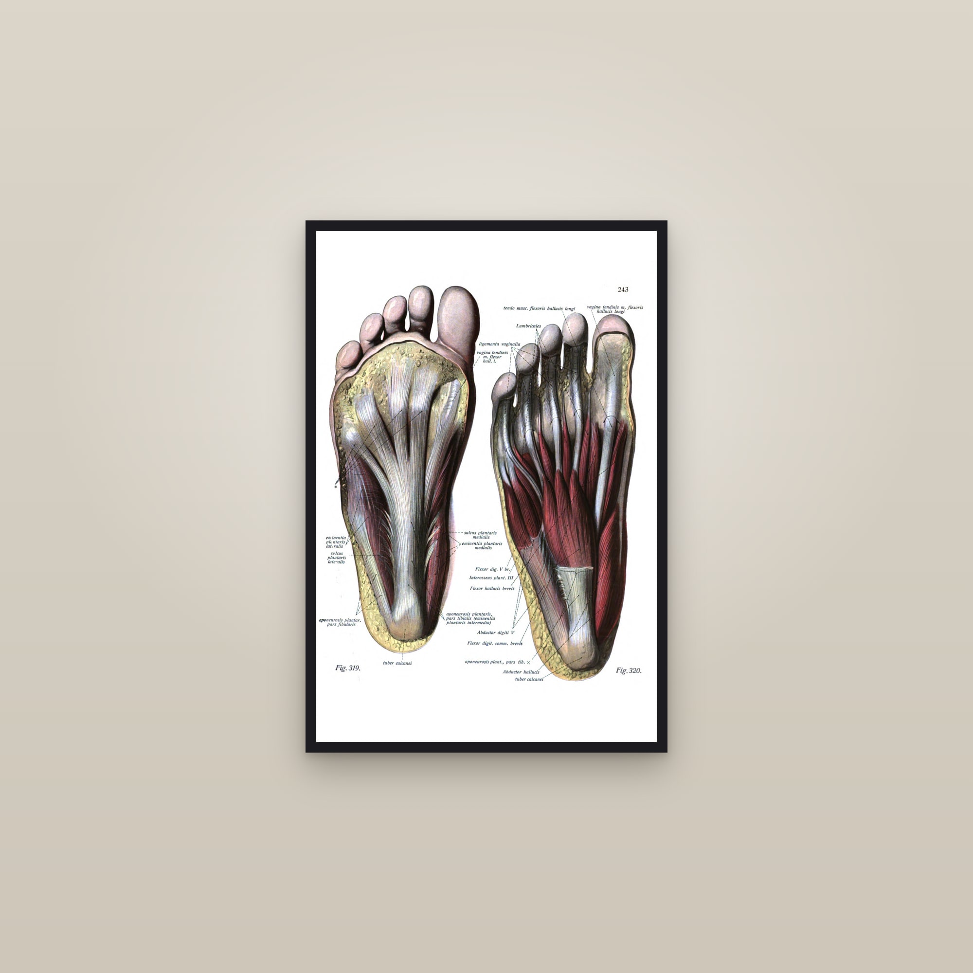 Muscles of the Sole of the Foot — framed in a gallery setting