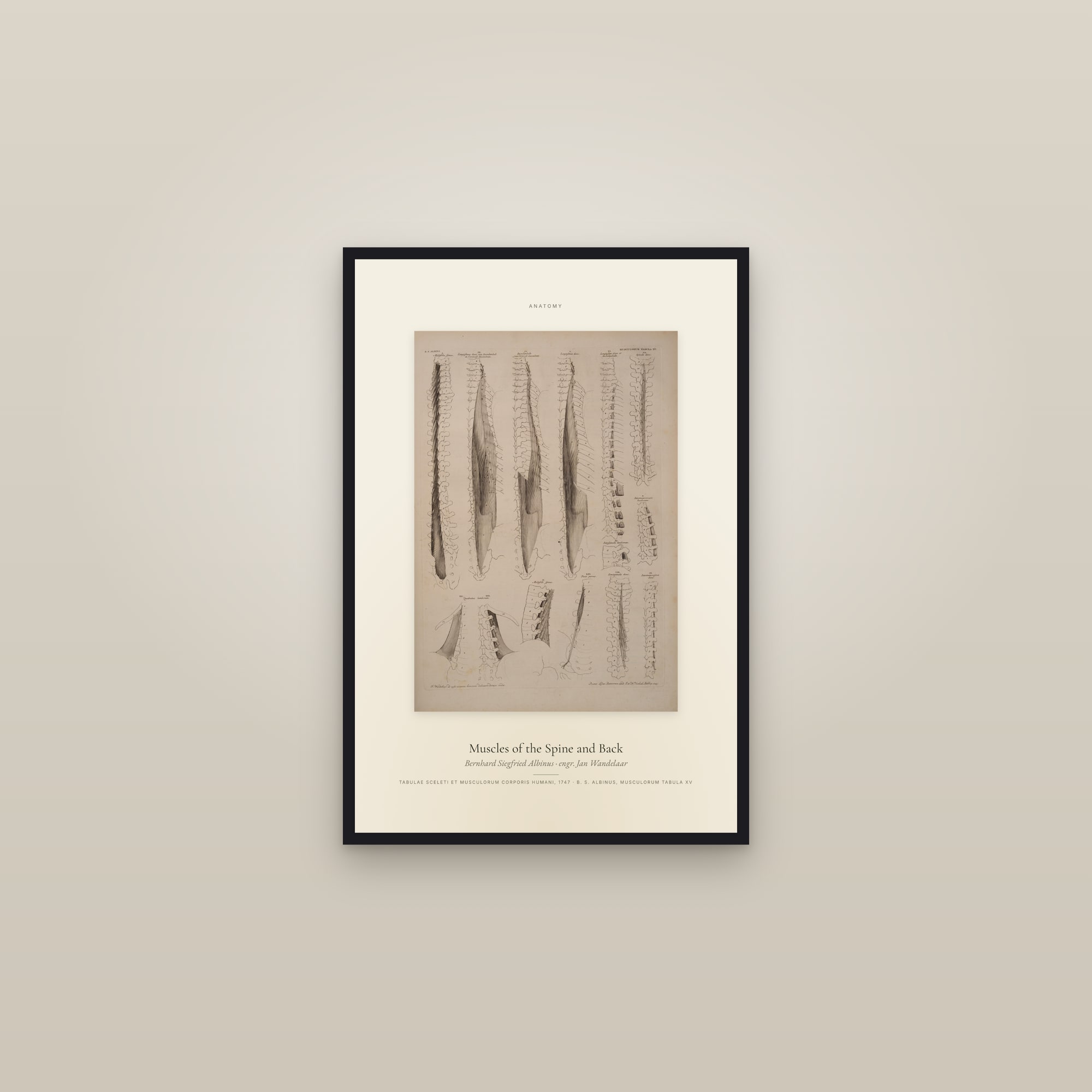 Muscles of the Spine and Back — Specimen — framed in a gallery setting