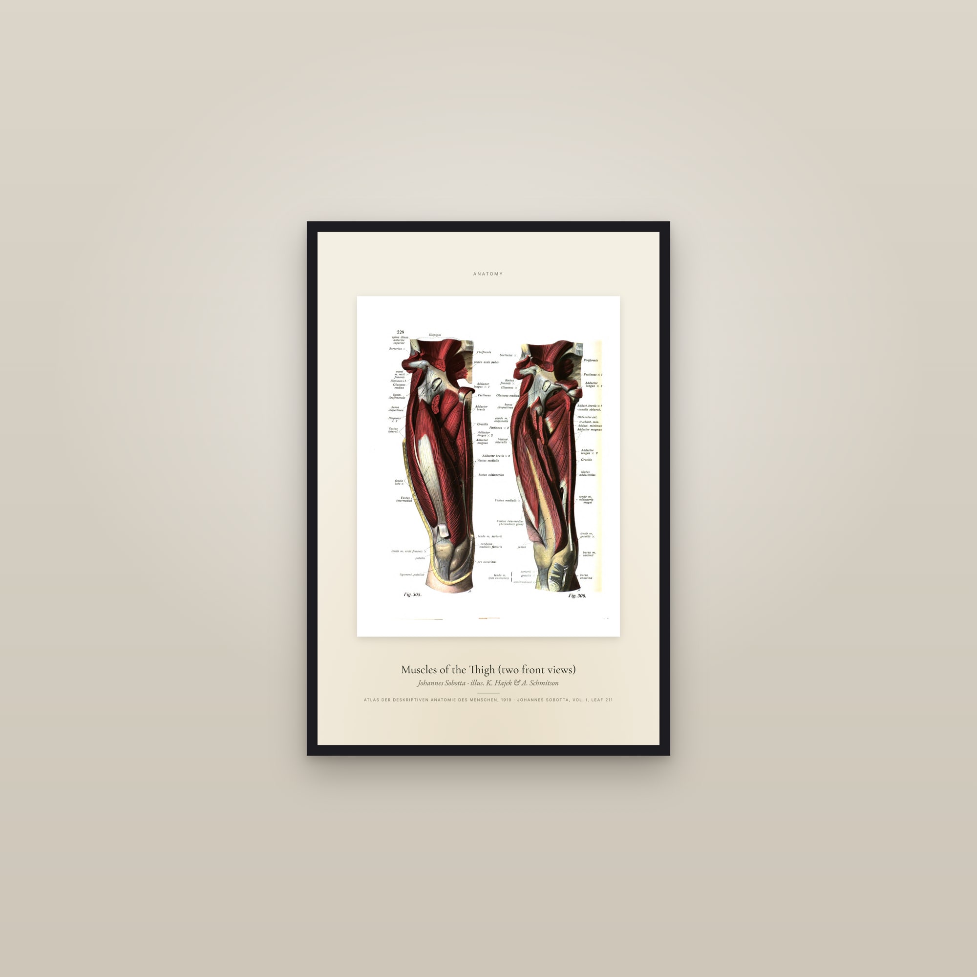 Muscles of the Thigh (two front views) — Specimen — framed in a gallery setting