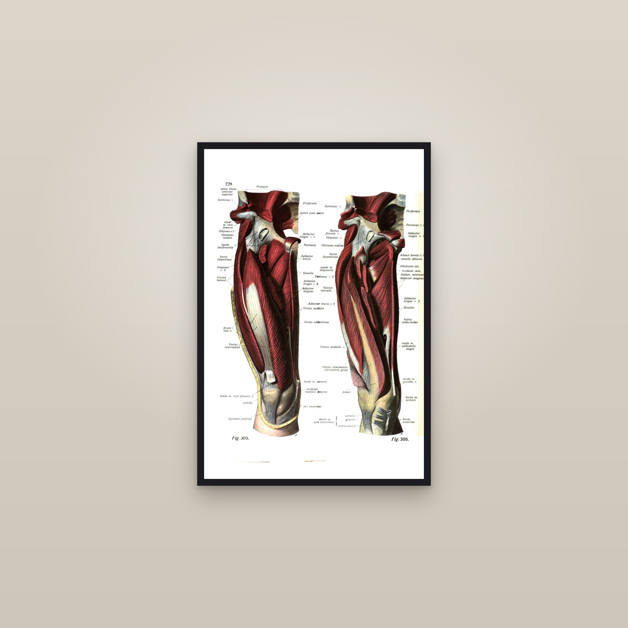 Muscles of the Thigh (two front views) — framed in a gallery setting